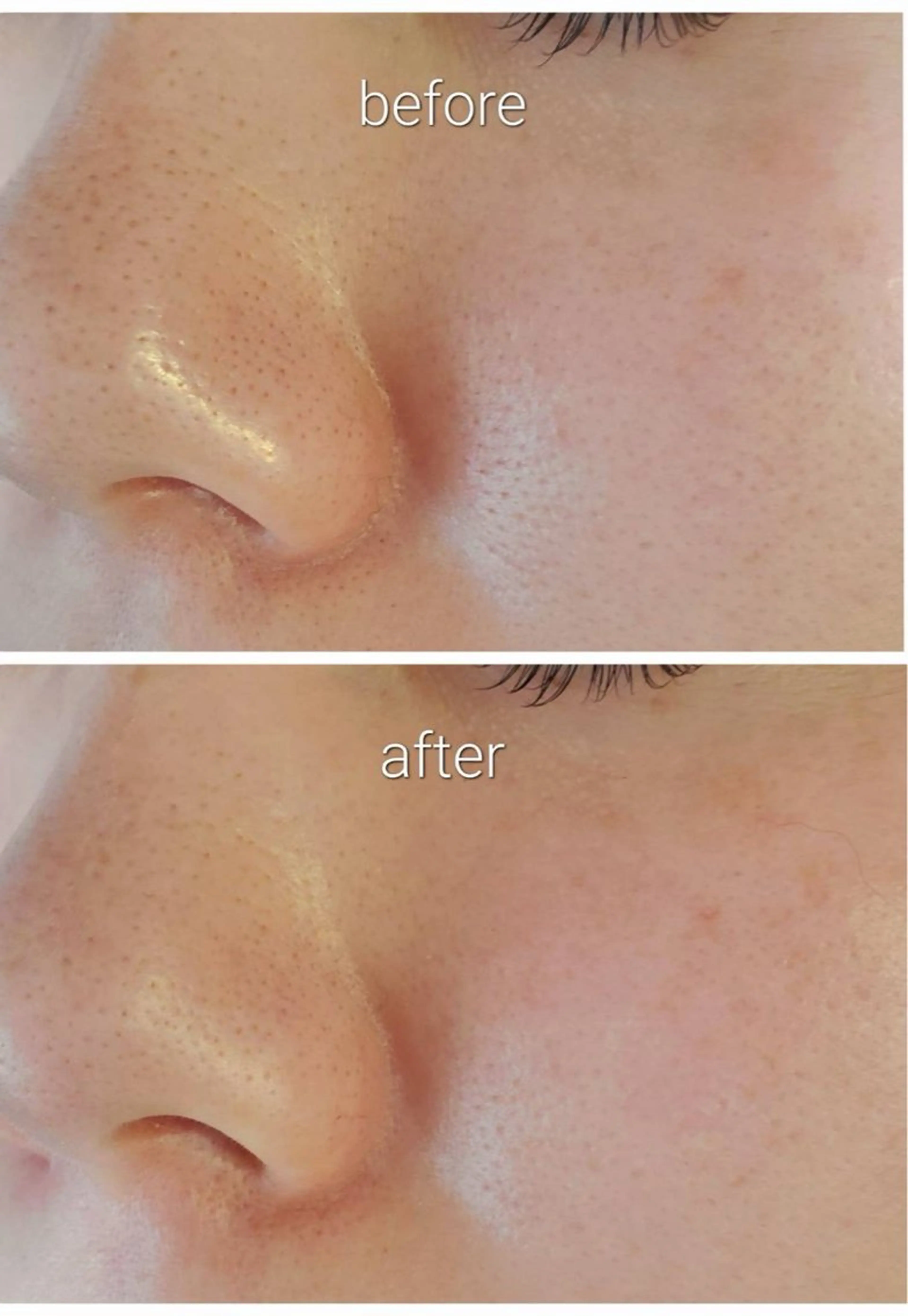 サロンur（ユア） Rieのエステ・リラクイメージ