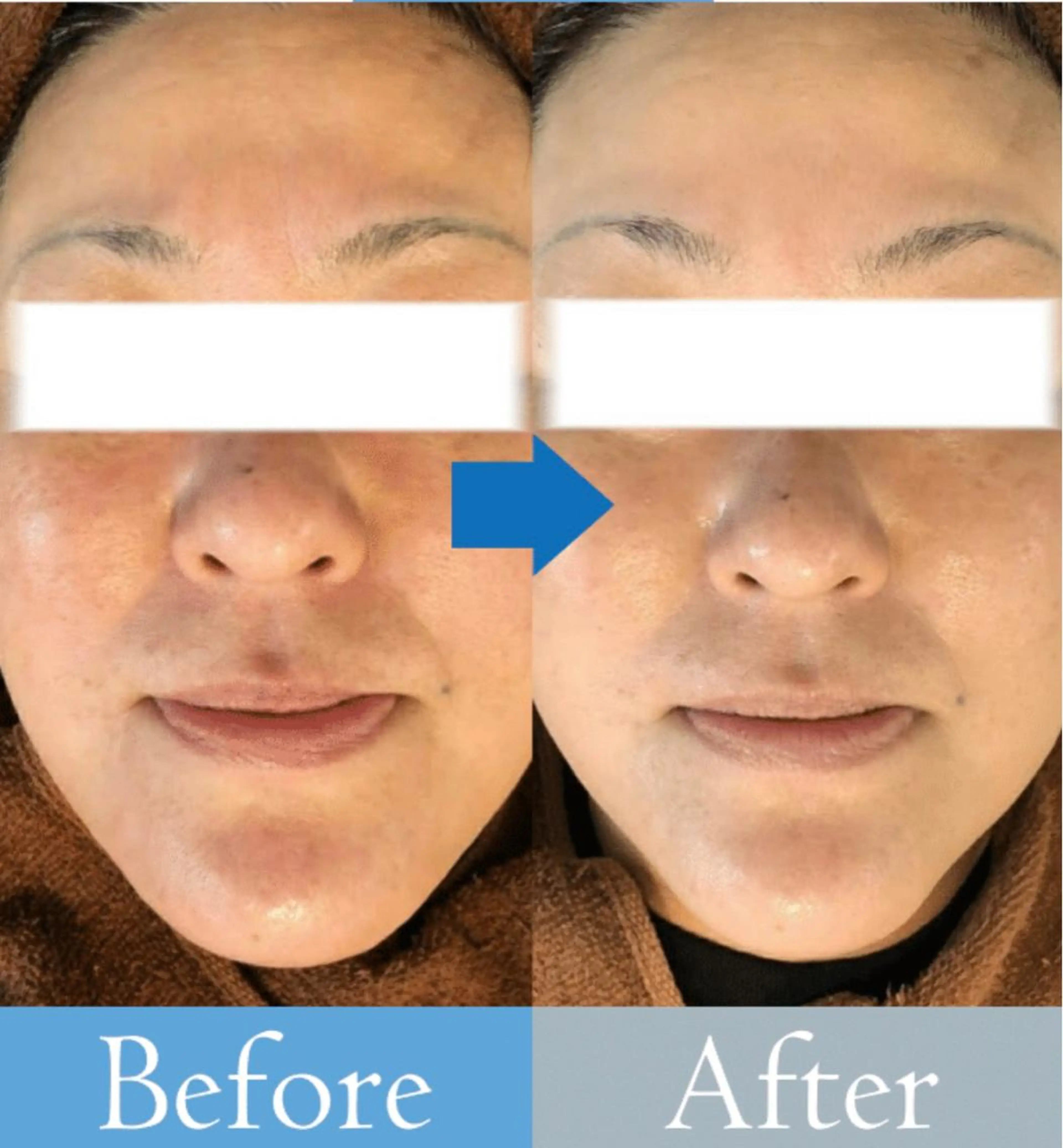 【医療提携エステ】 ルミナス北浦和のその他イメージ