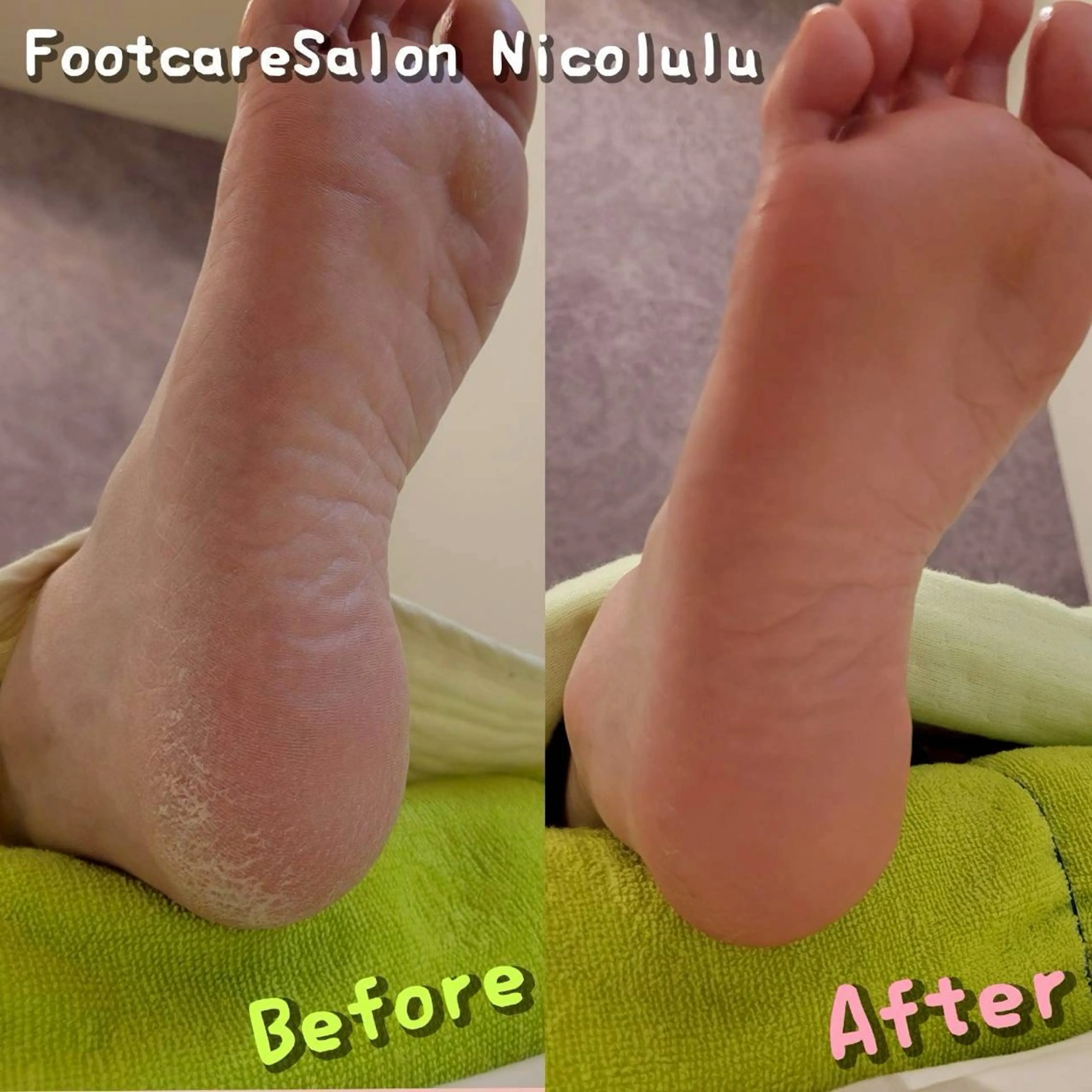 リラク 足トラブル専門 ニコルル金沢のエステ・リラクイメージ