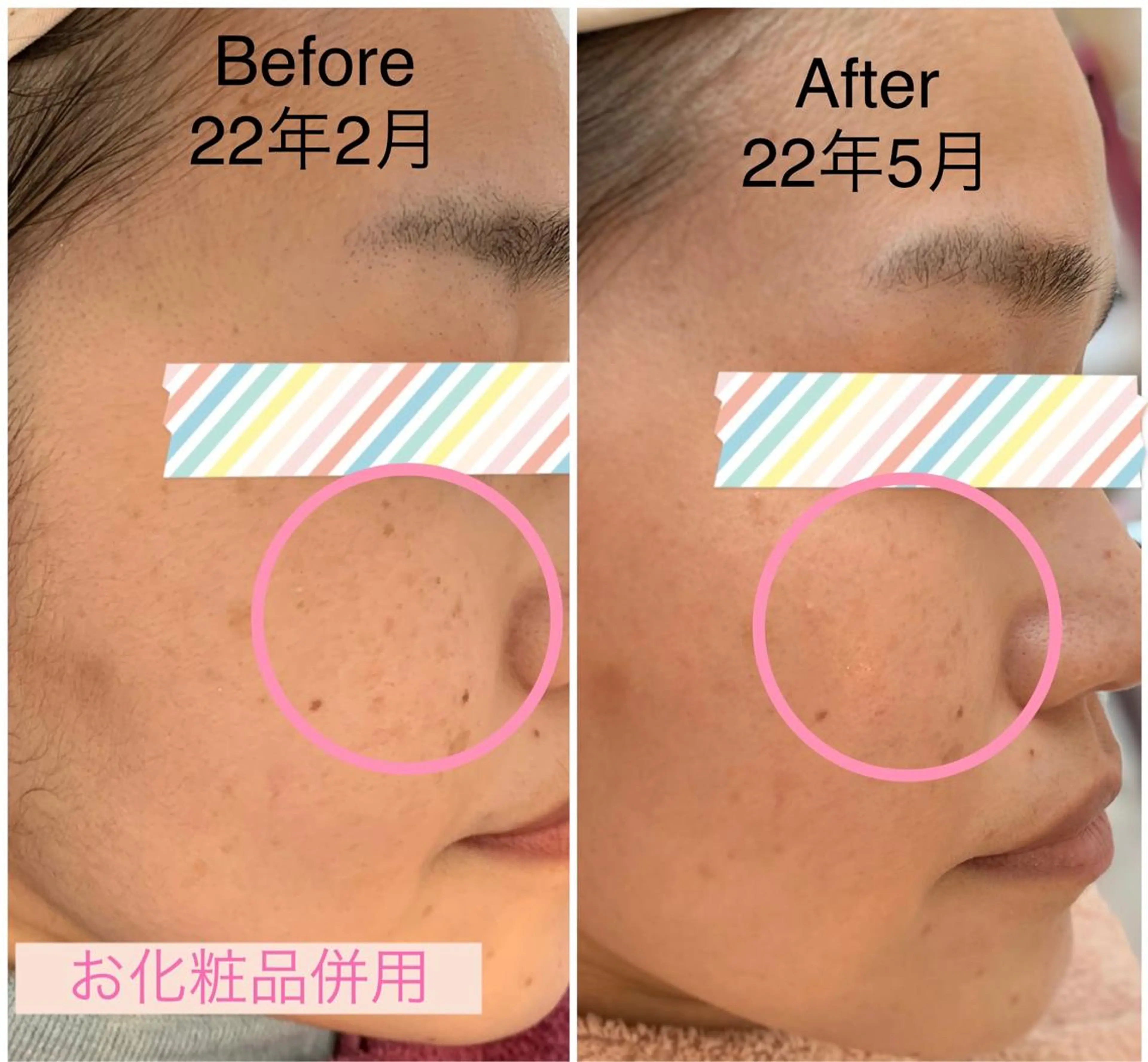 シミケア E Lashのエステ・リラクイメージ