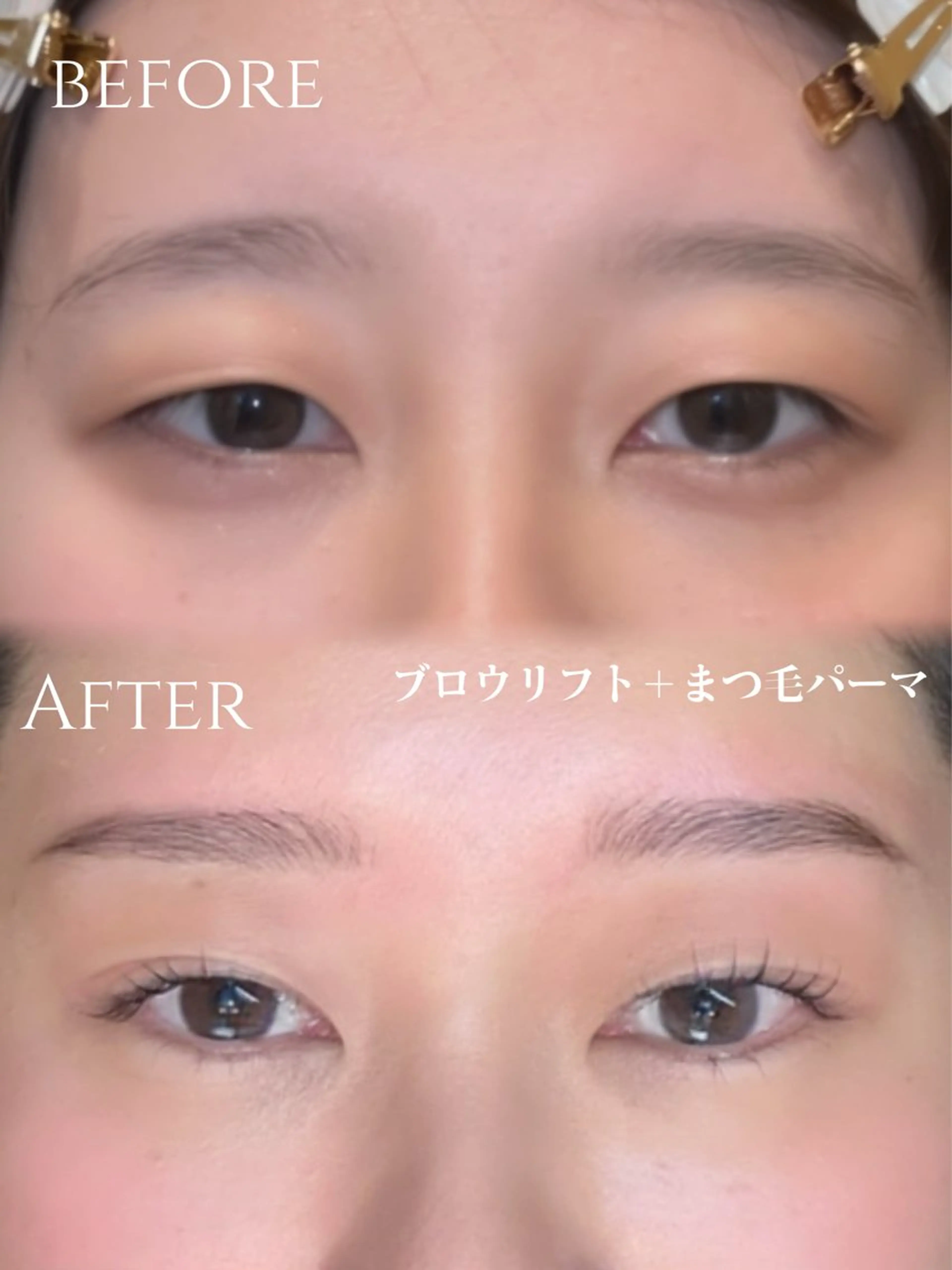 ブロウリフト【毛流れ改善+トリートメント+WAX脱毛】の写真