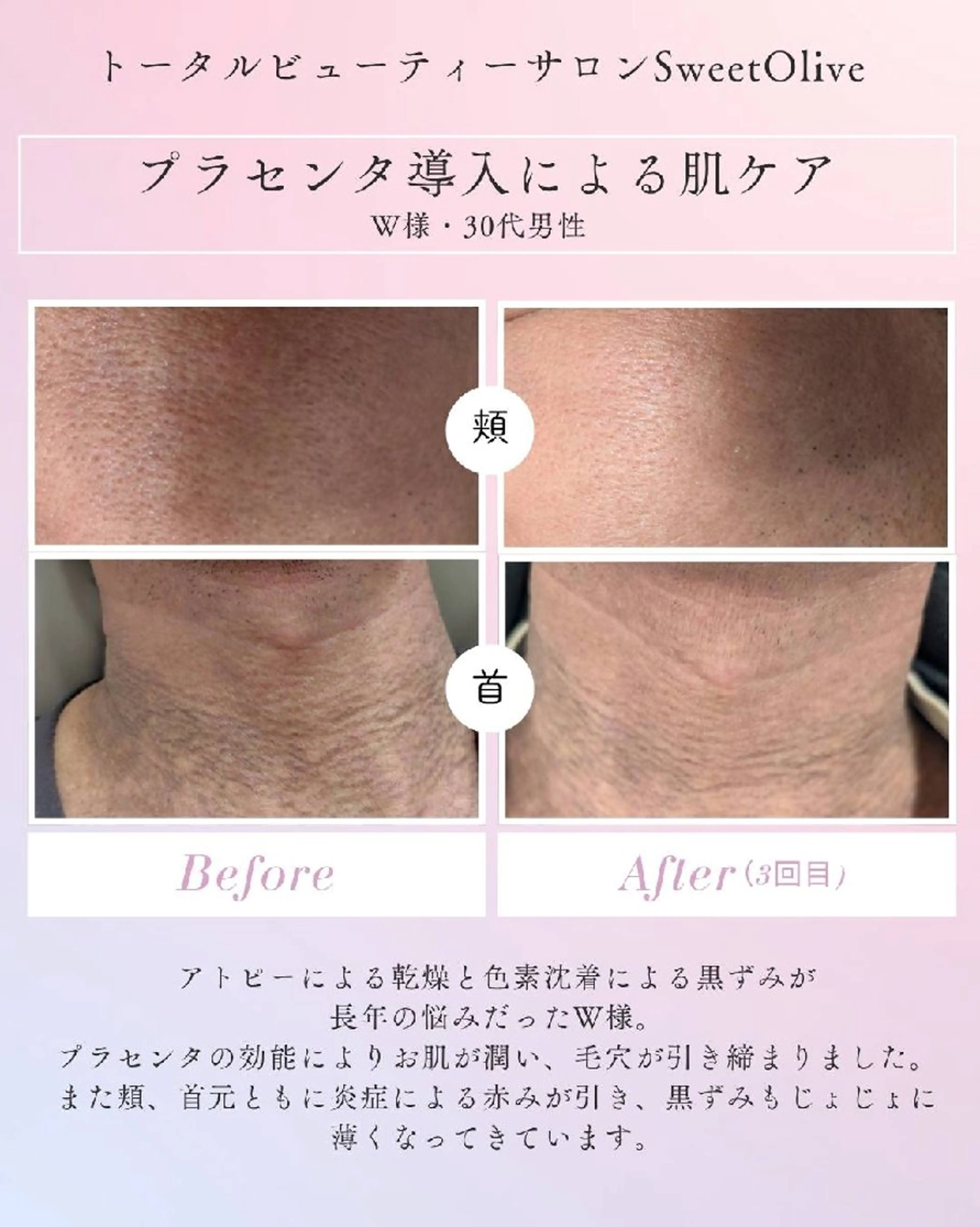 エステ SweetOlive 　 Akaneのエステ・リラクイメージ