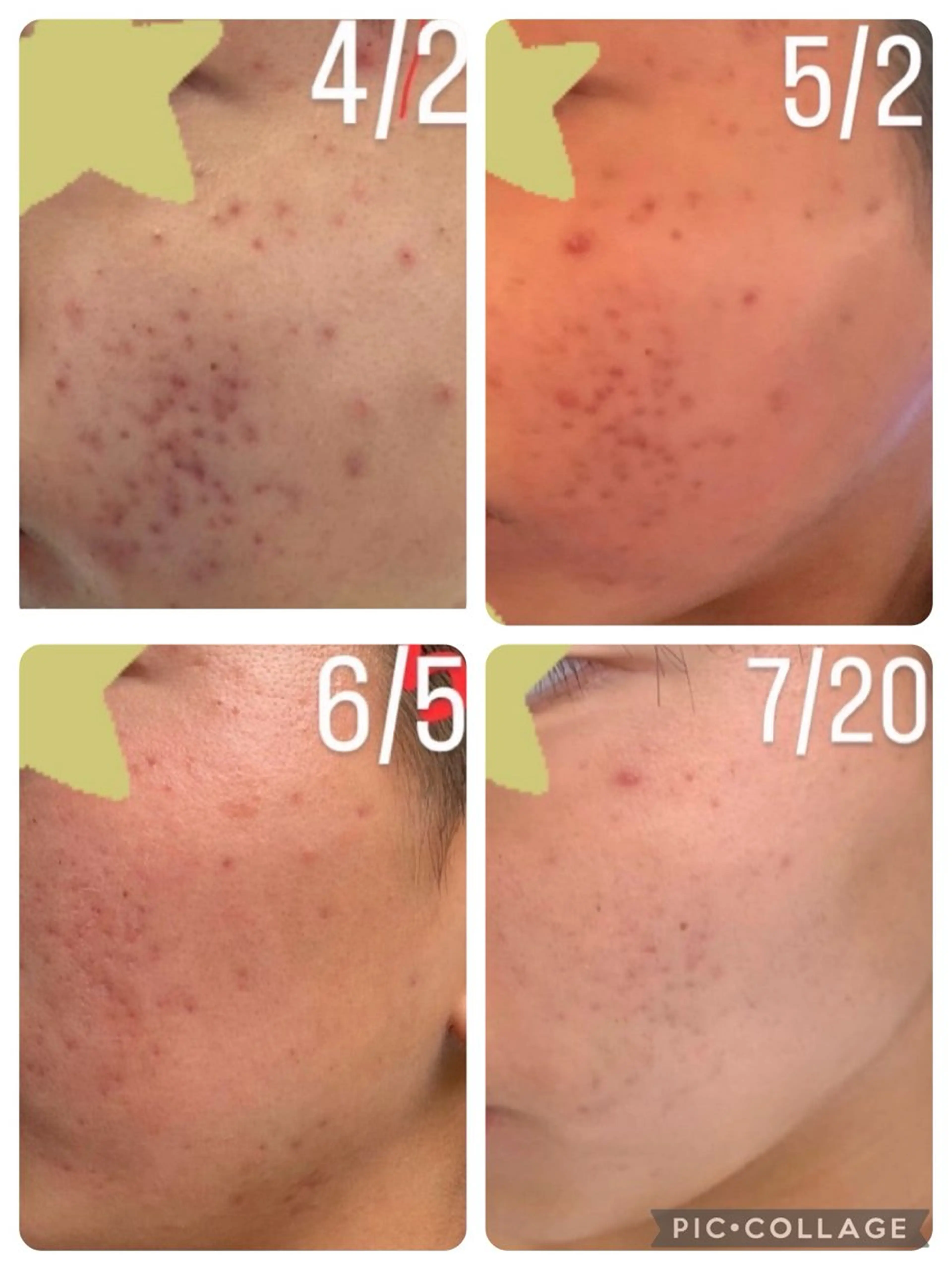 エステ sourire.11 ‪☺︎‬‪emiのその他イメージ