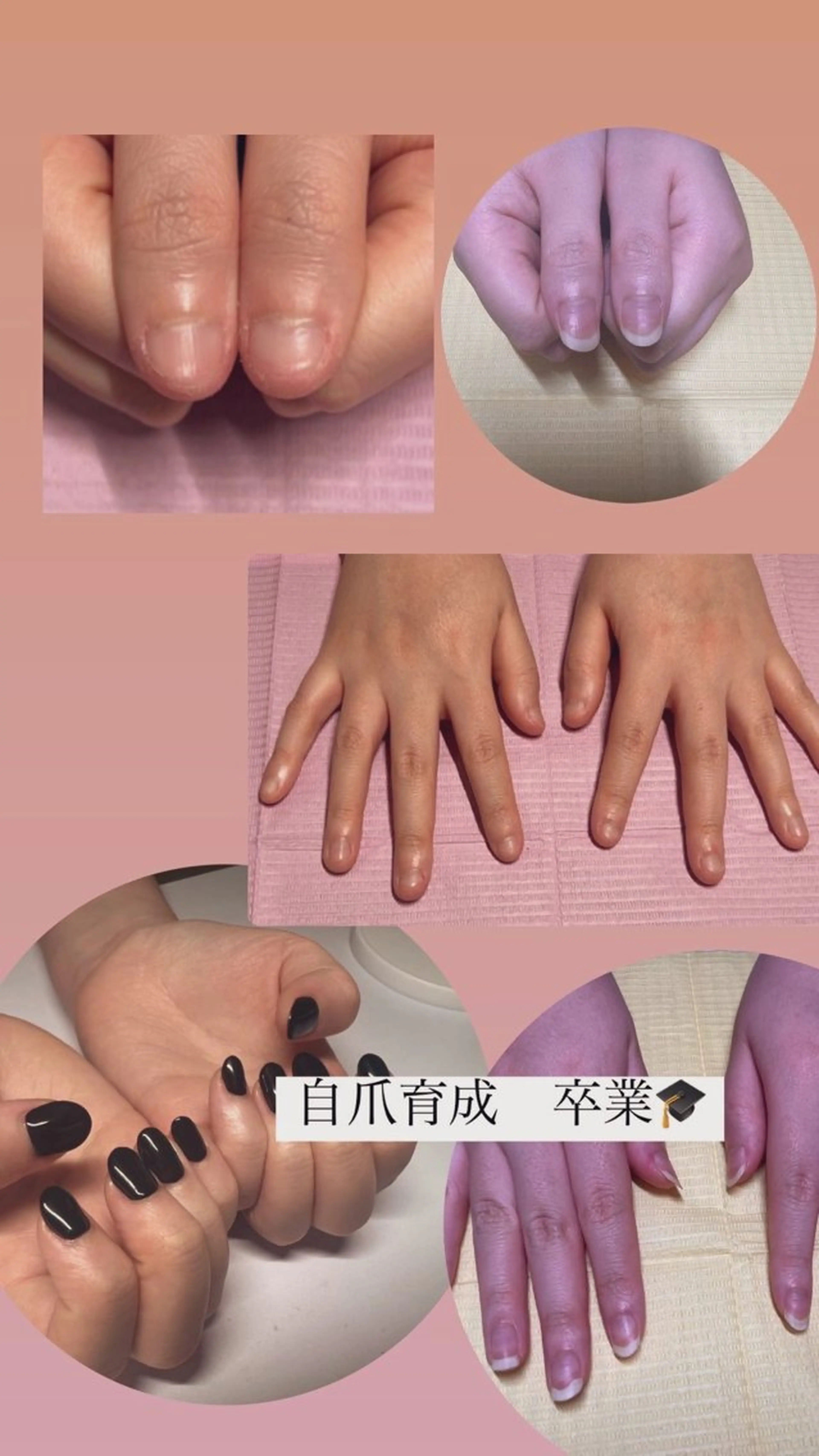 メンズ ネイル 爪ケア/深爪 自爪育成 🐰えむのネイルデザイン