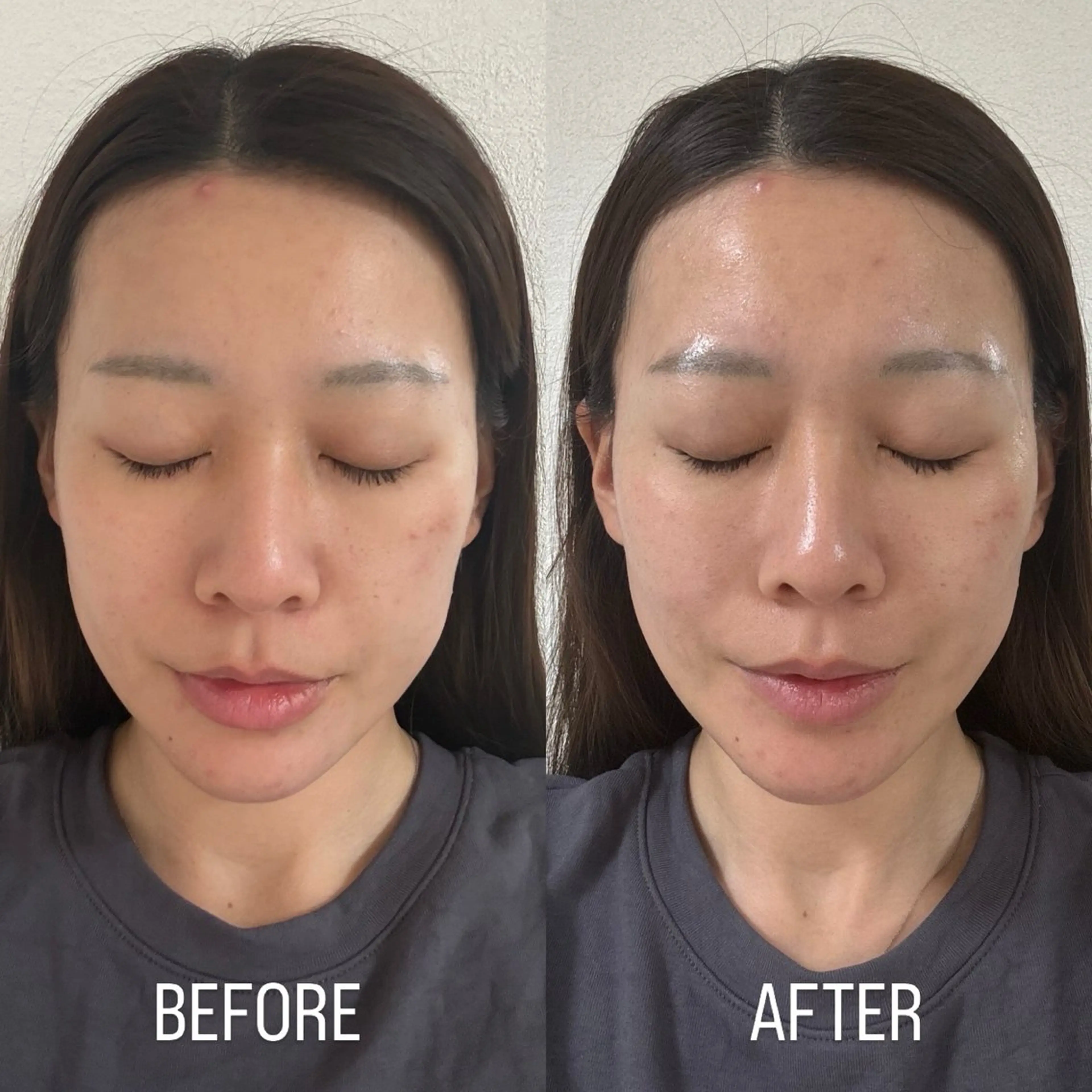 韓国ツヤ肌❤️‍🔥SNOW PEEL✖️LHA SHOTの写真