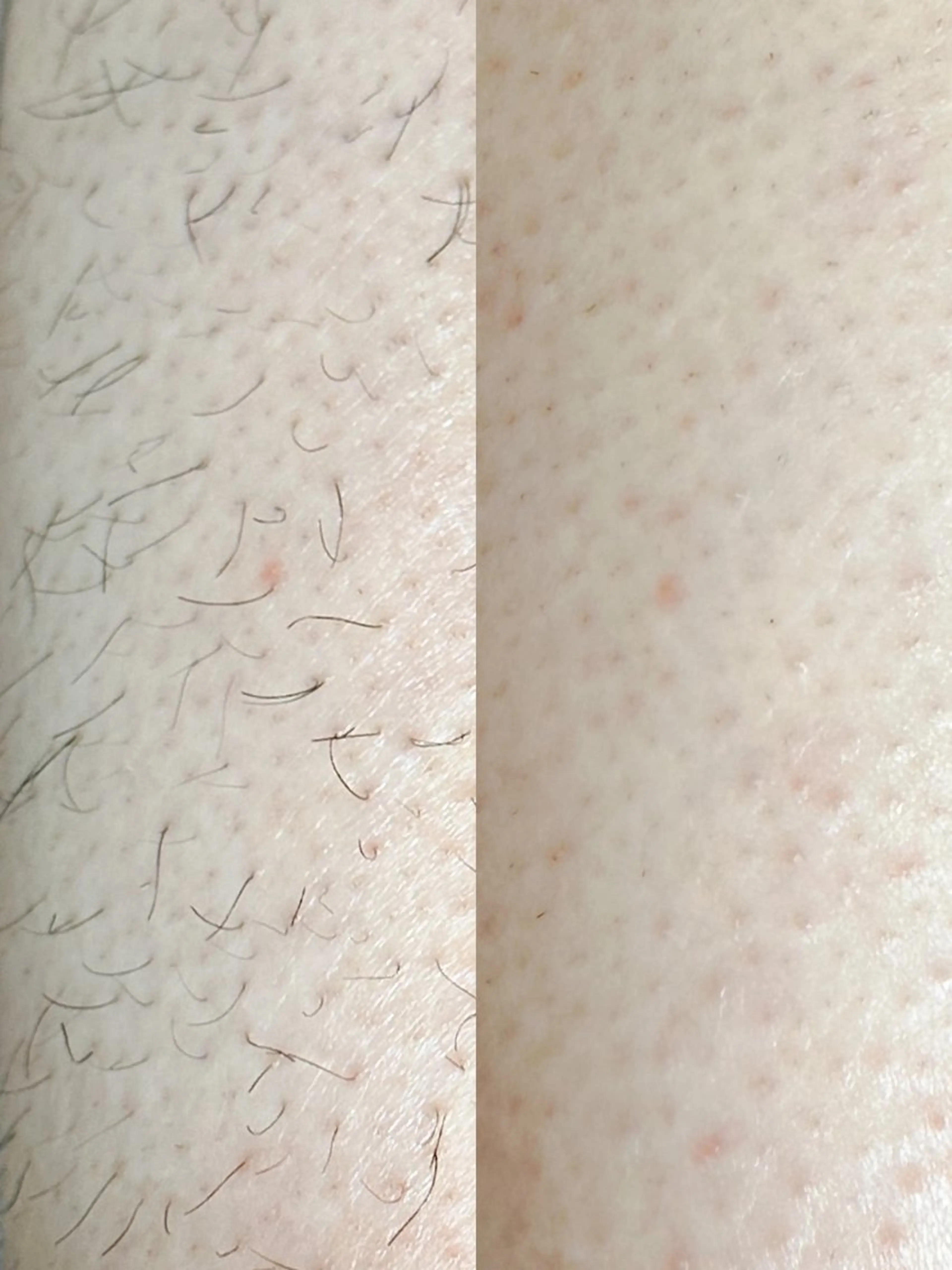 Hitomi シュガーリング豊橋のその他イメージ