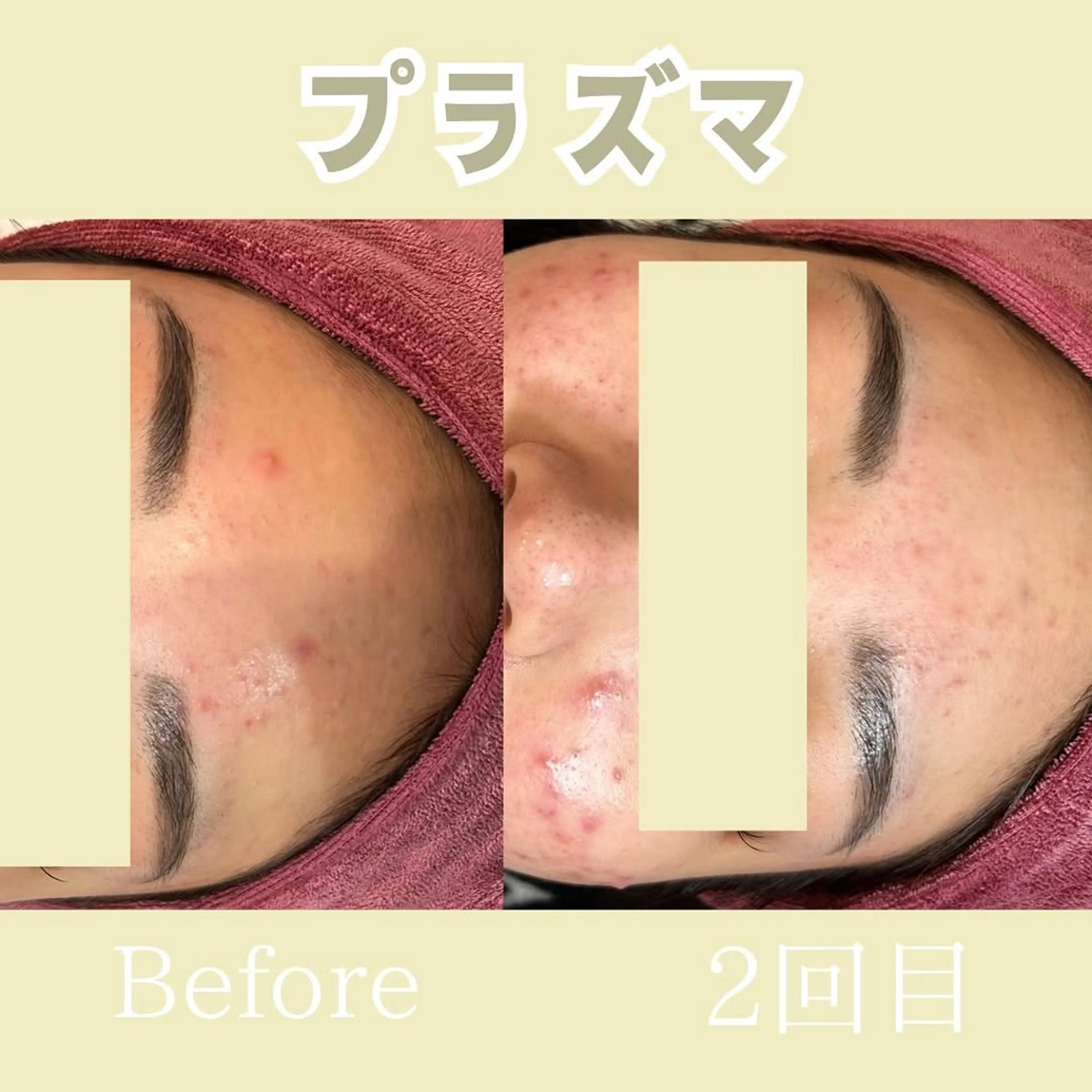 小顔矯正専門店 【RED】池田のエステ・リラクイメージ