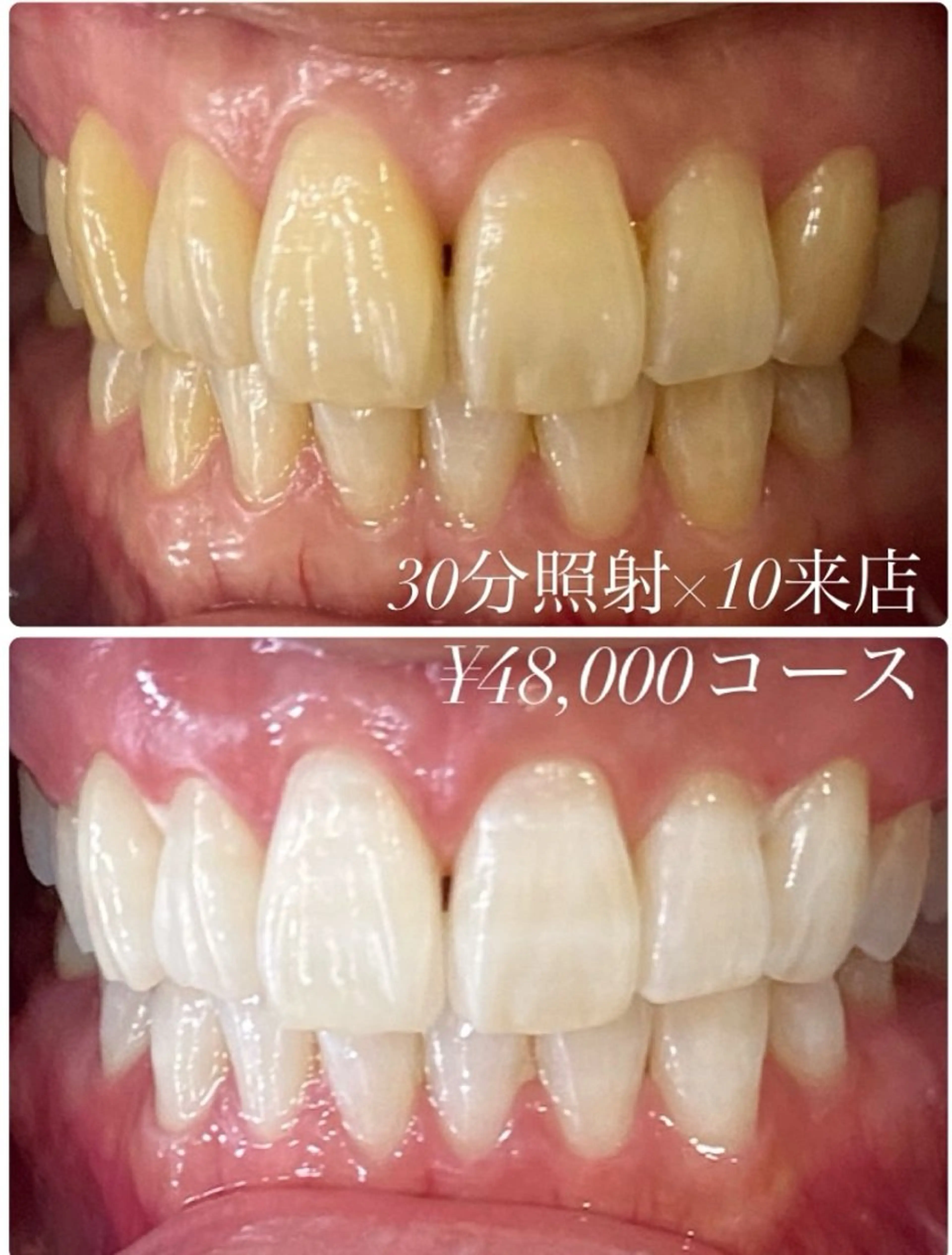 その他 ホワイトニング ルーム　川崎店のその他イメージ