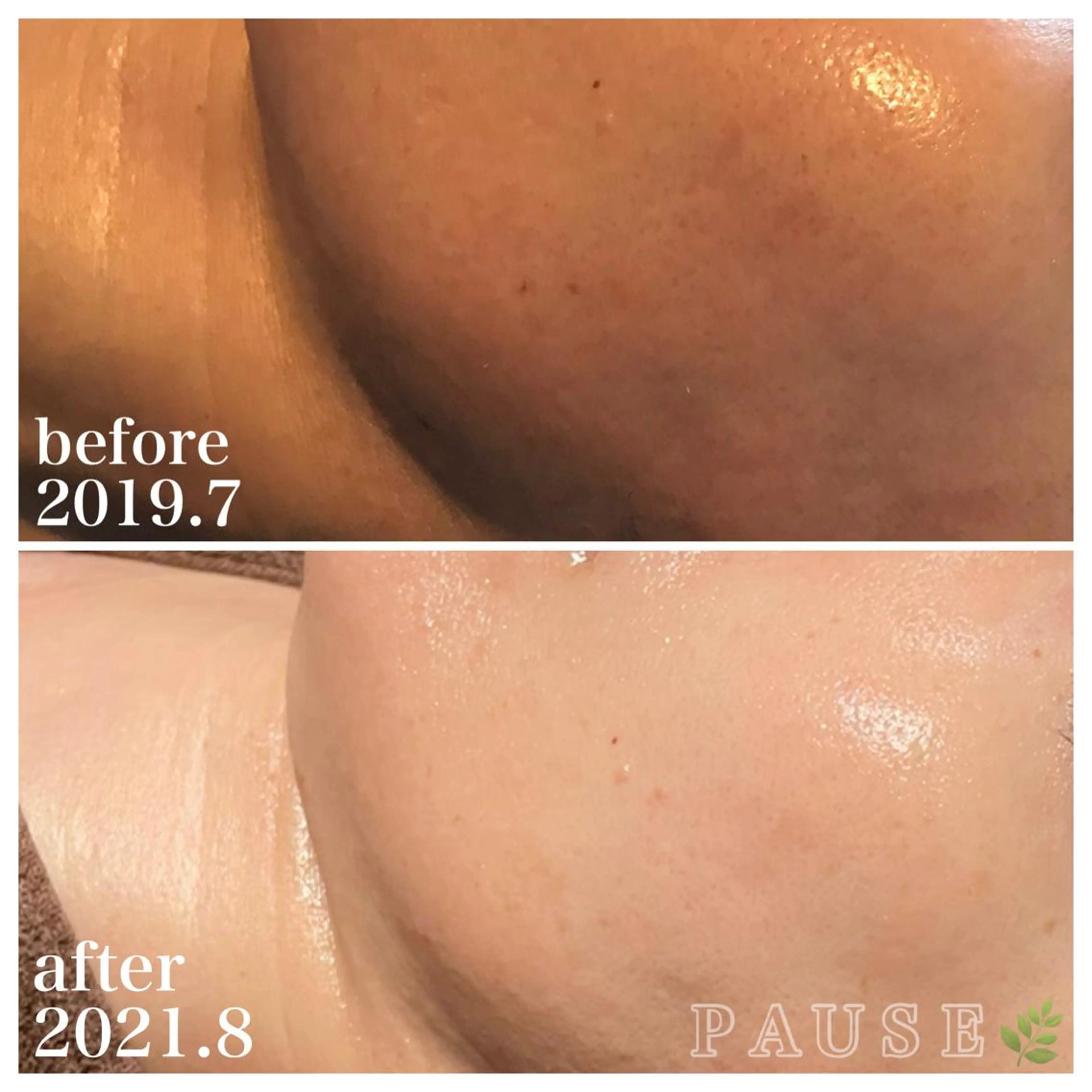 エステ リラク 浜野 恵美のエステ・リラクイメージ