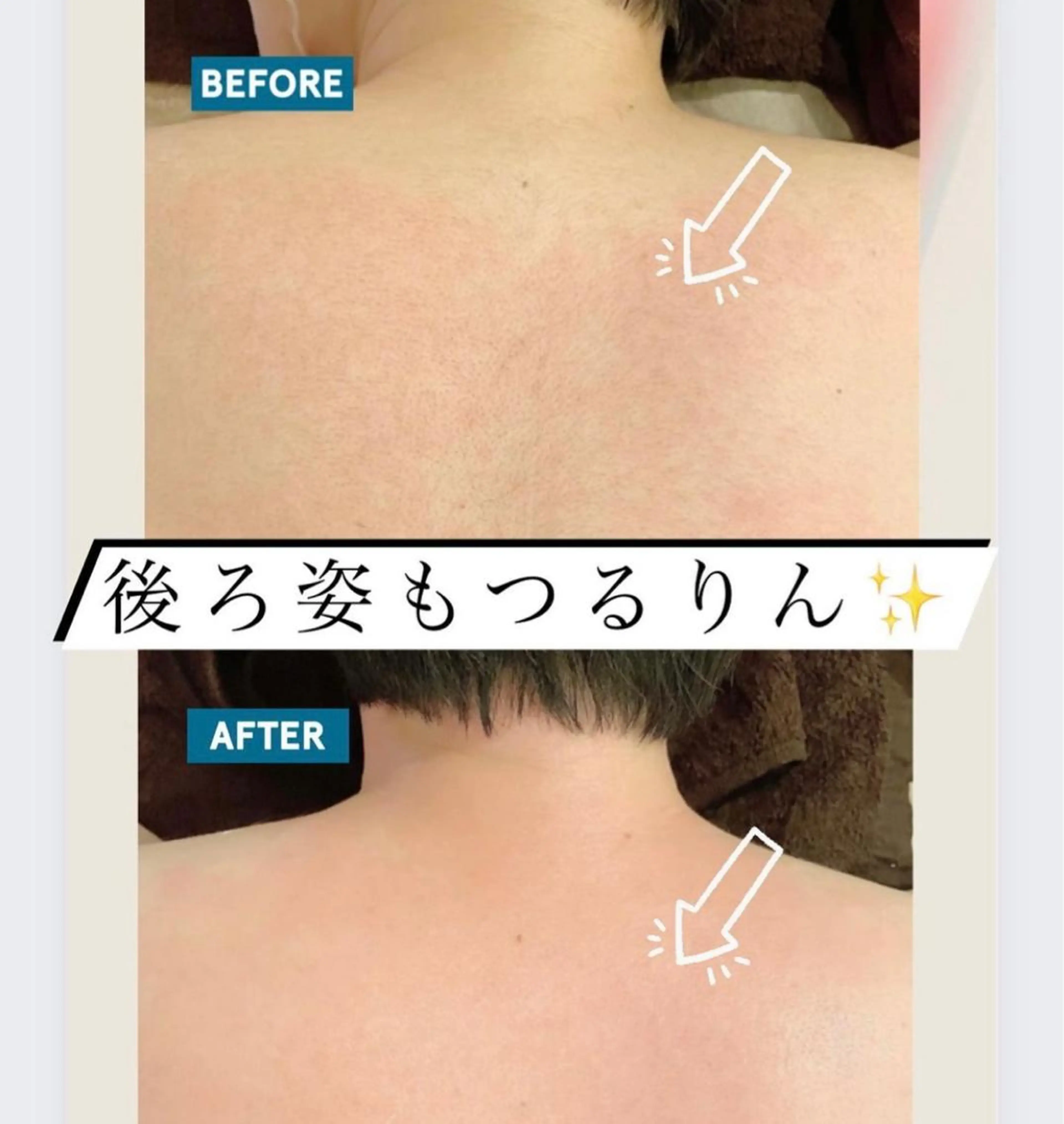 ショート メンズ 河上★うなじや首回り Wax脱毛が得意ですのエステ・リラクイメージ