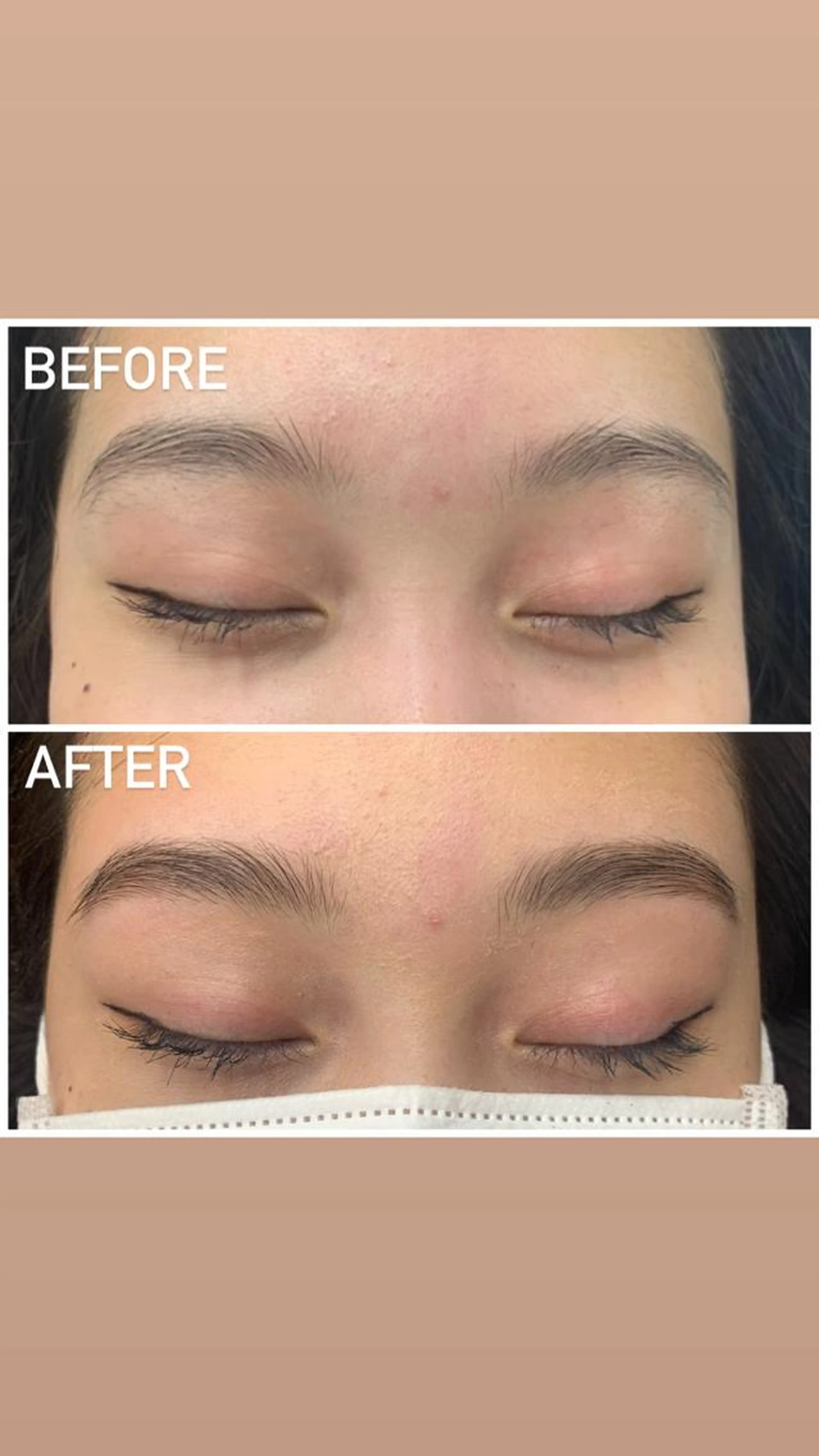 フェイス全面Waxの写真