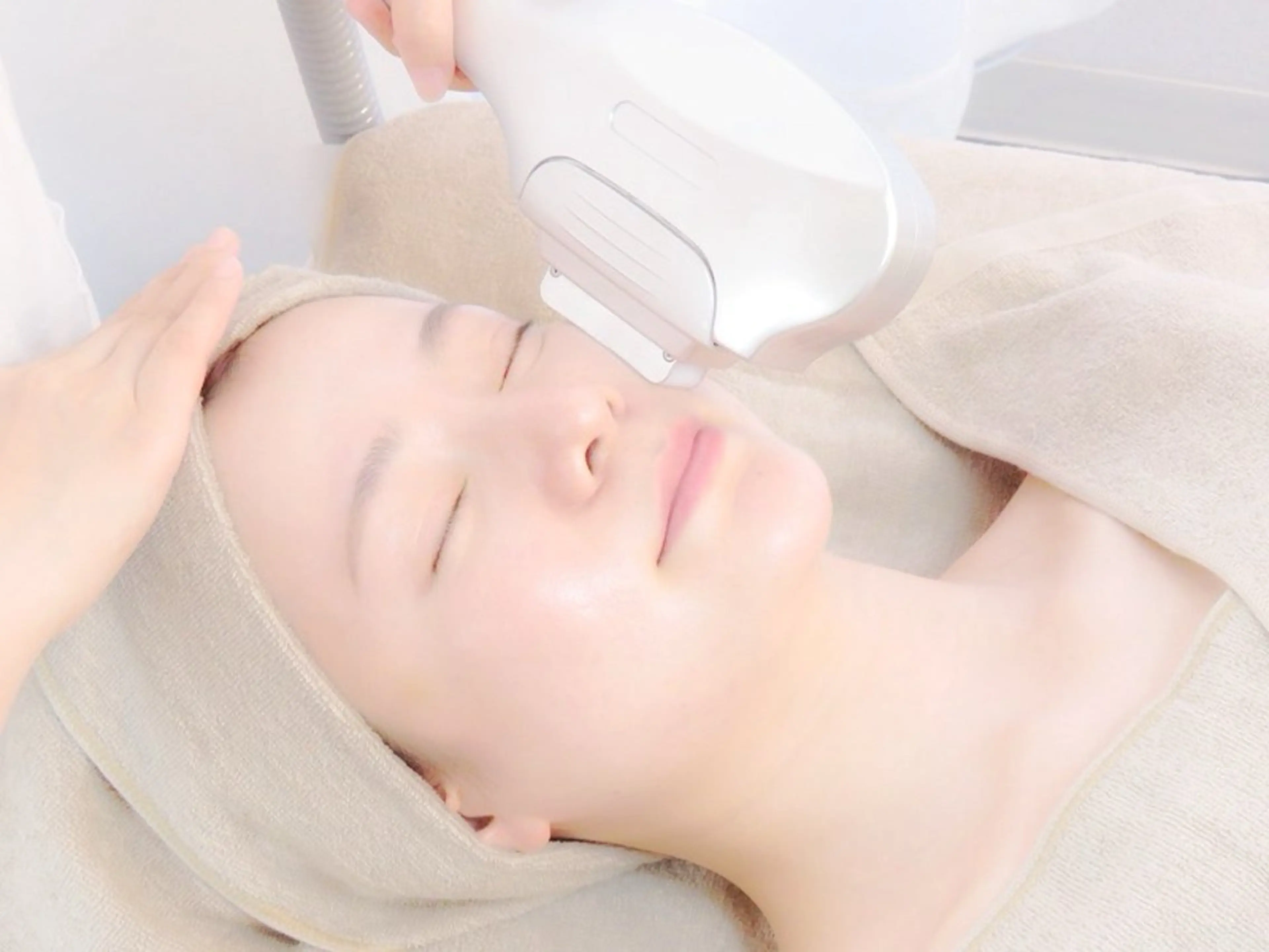 ✨【ミニモ限定】顔美肌脱毛【産毛全顔丸ごと脱毛】美白パック付き うぶ毛さよならちゅるん肌※口コミ必須の写真