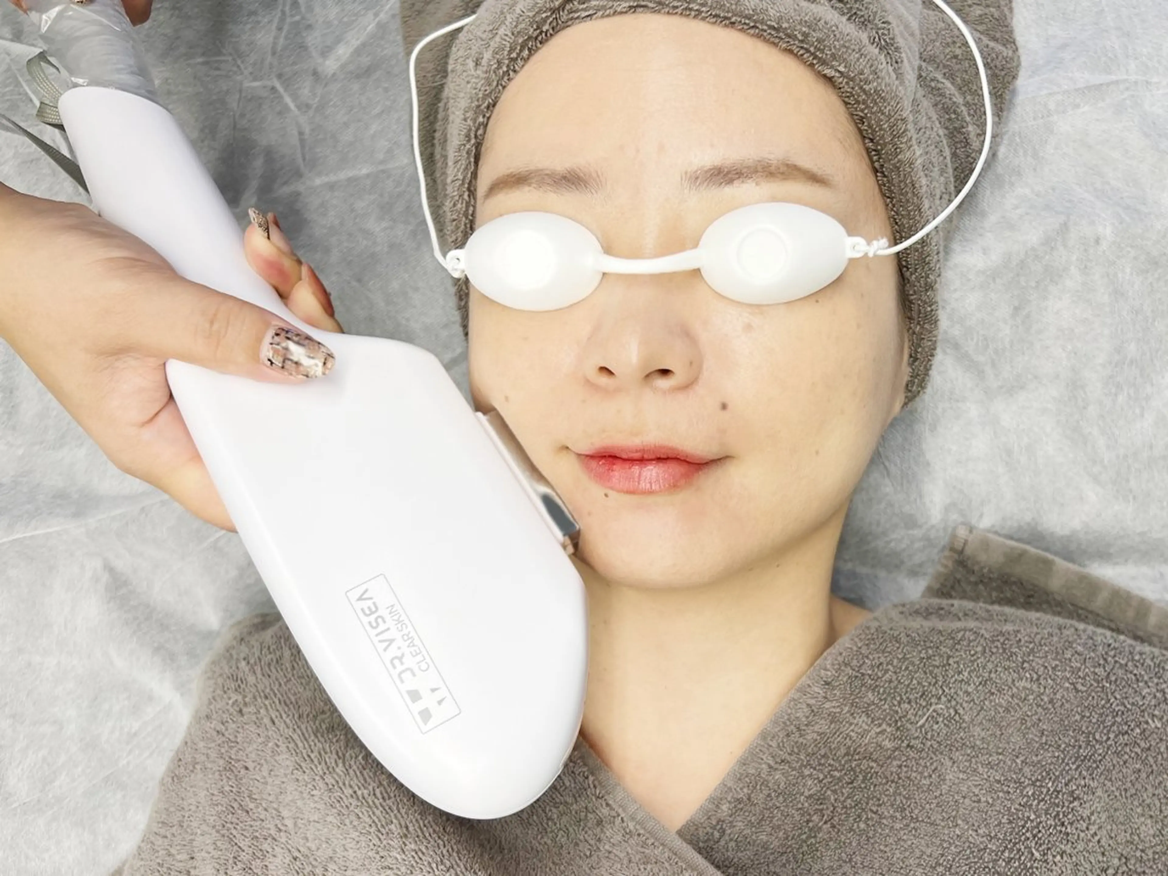 脱毛モデル募集します💫レディース全身脱毛3回(お顔➕VIO含む)の写真