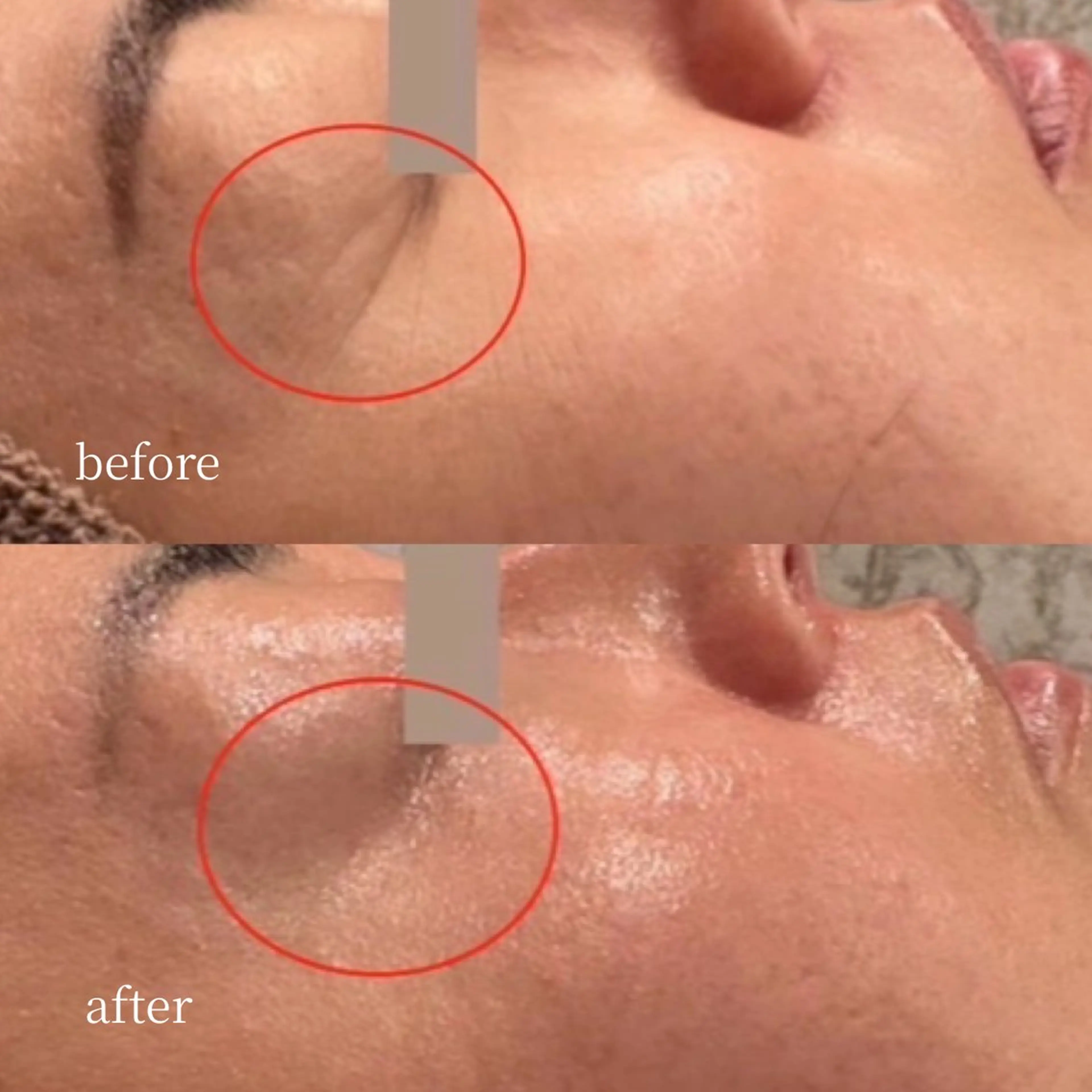 韓国肌管理・肌質改善 EARNEST心斎橋のエステ・リラクイメージ