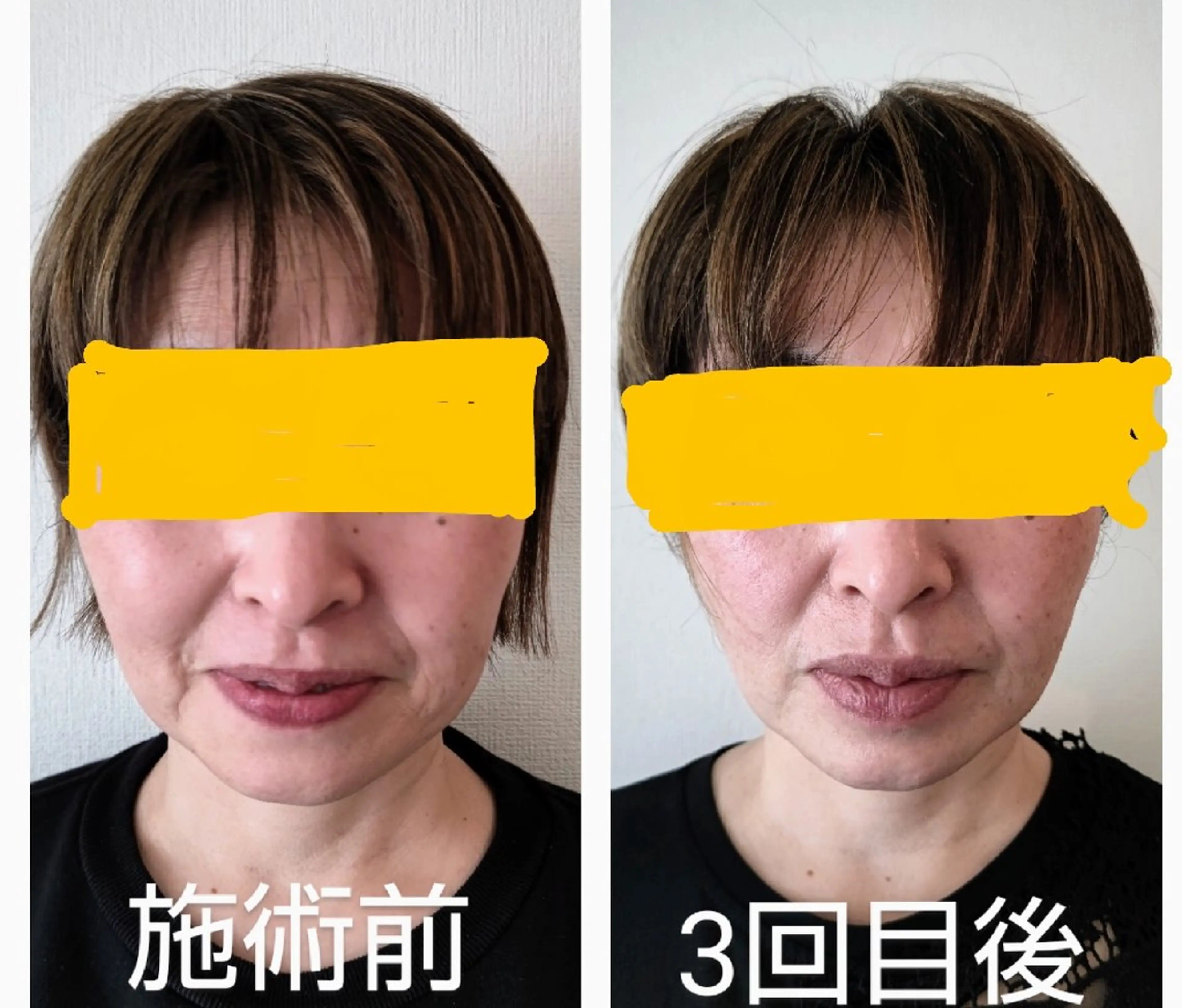 小顔矯正夙川 カレーズのエステ・リラクイメージ