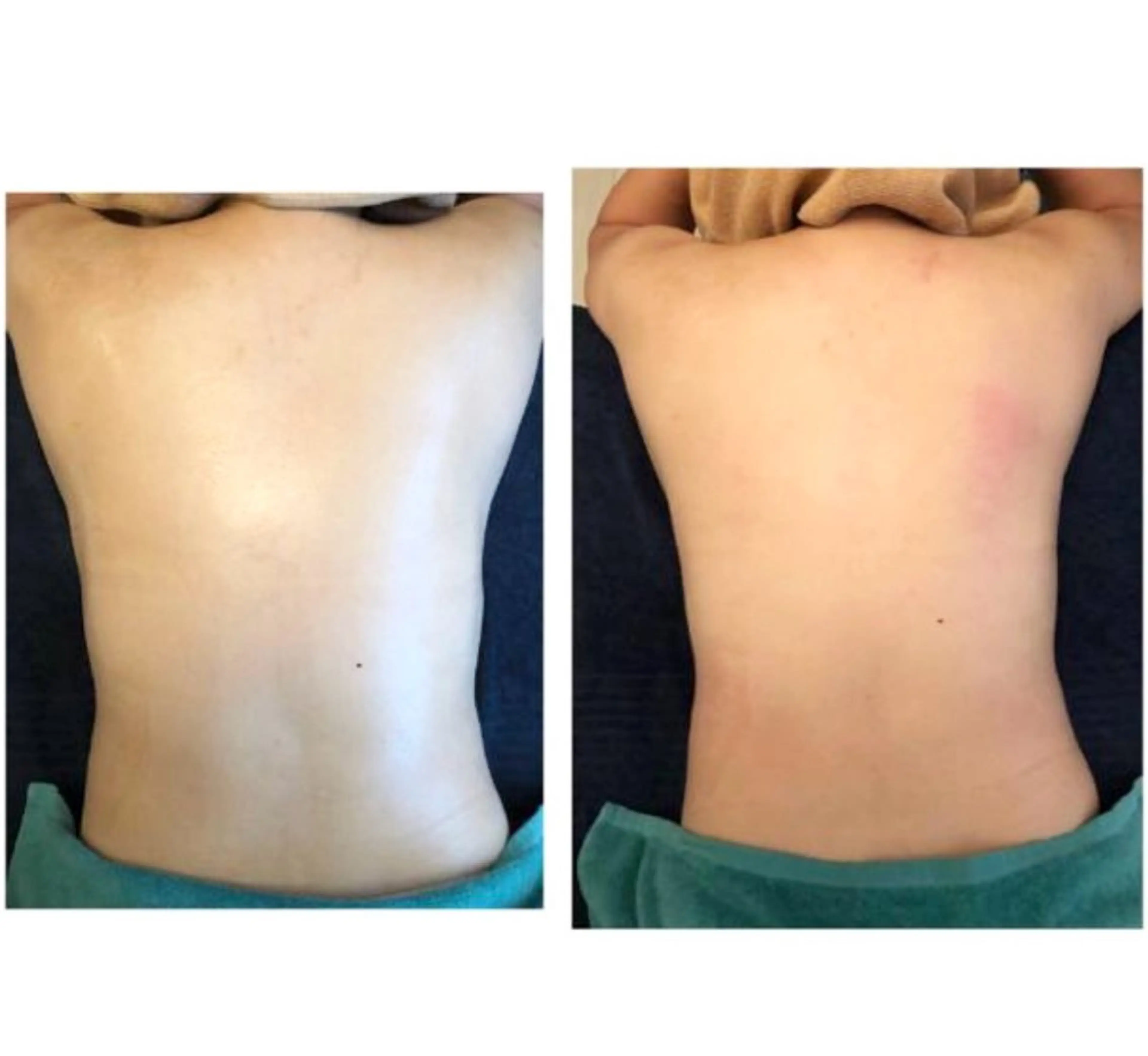 エステ リラク おうちサロン B-ROOMのエステ・リラクイメージ