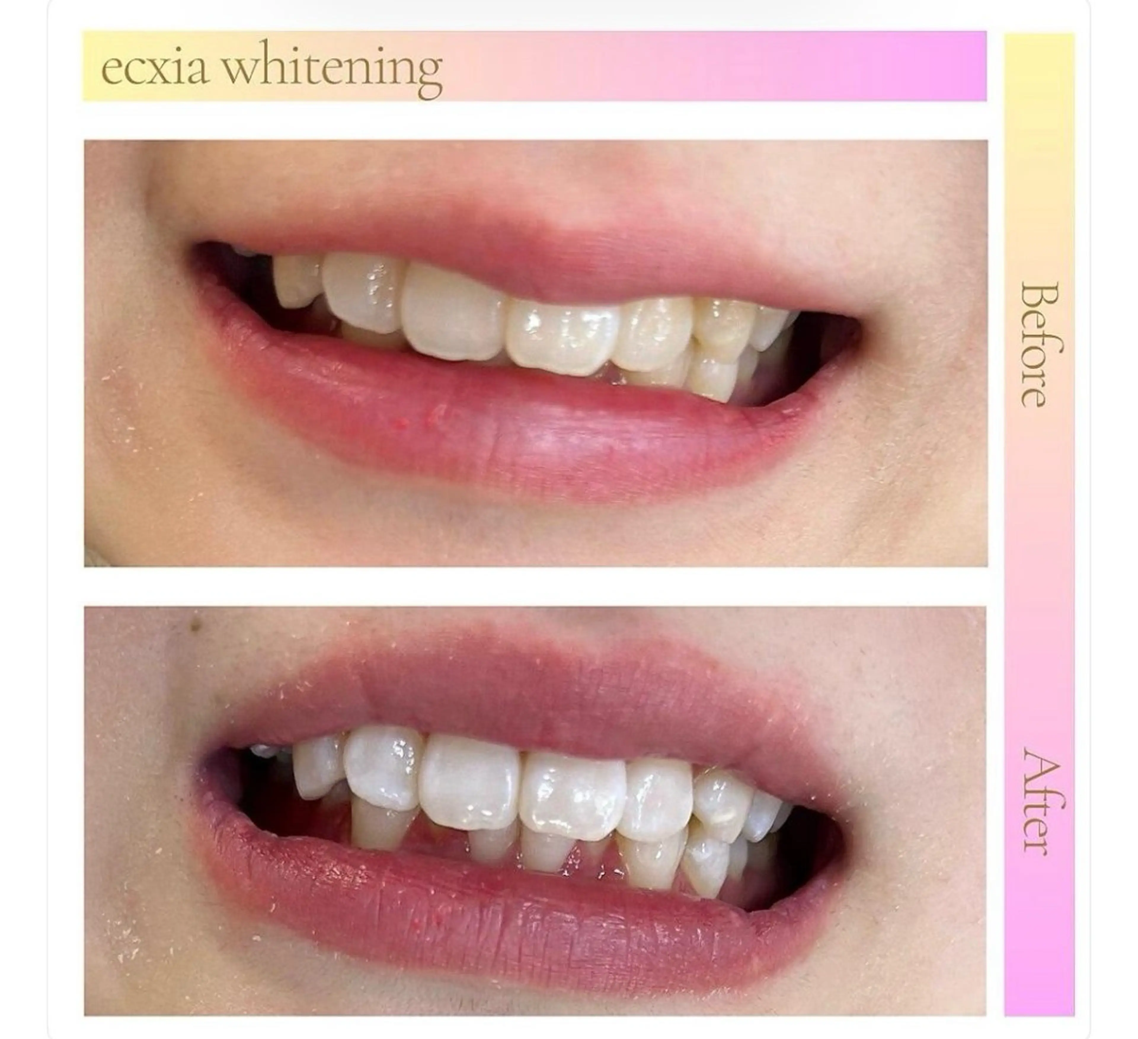 その他 ecxia新白河店 ゆきのその他イメージ