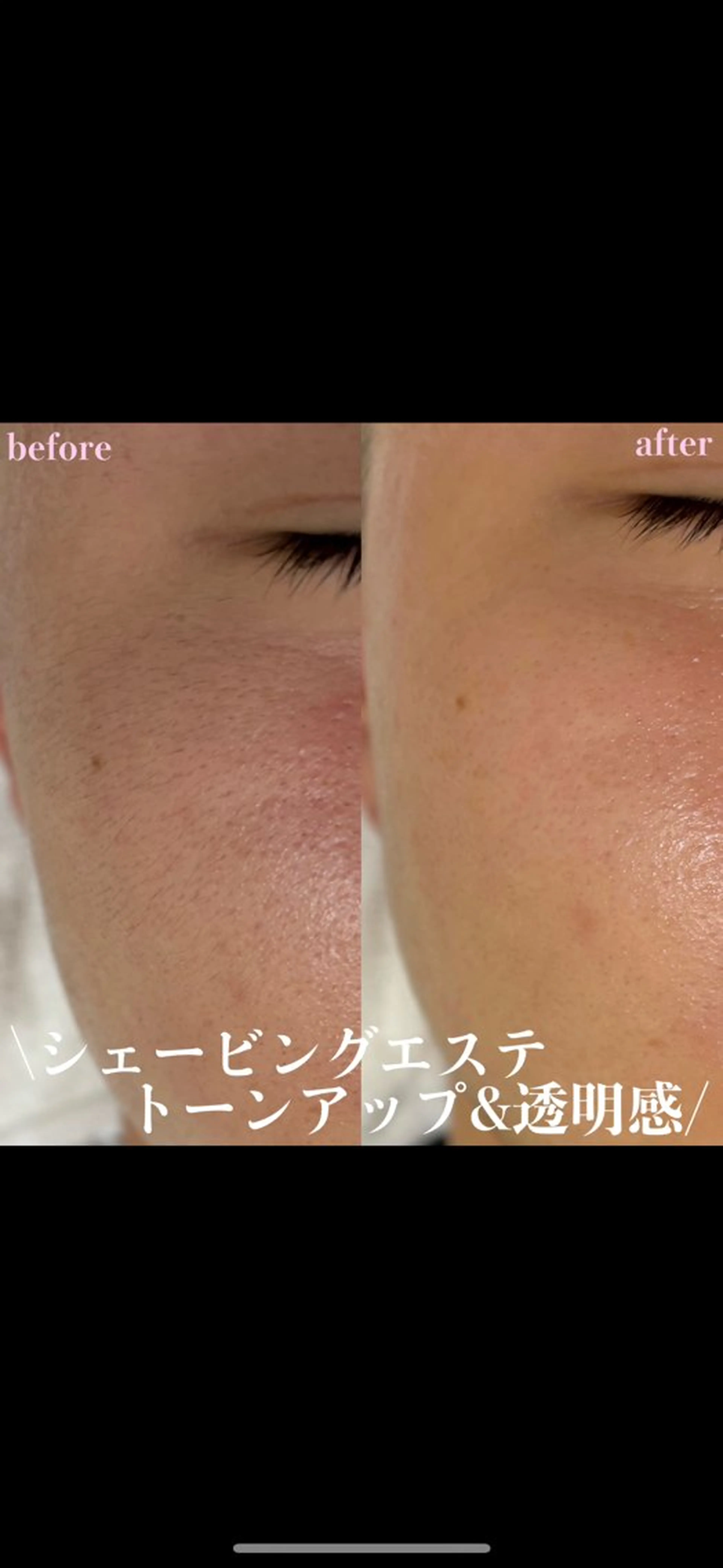 女性専門お顔剃り sunraineのエステ・リラクイメージ