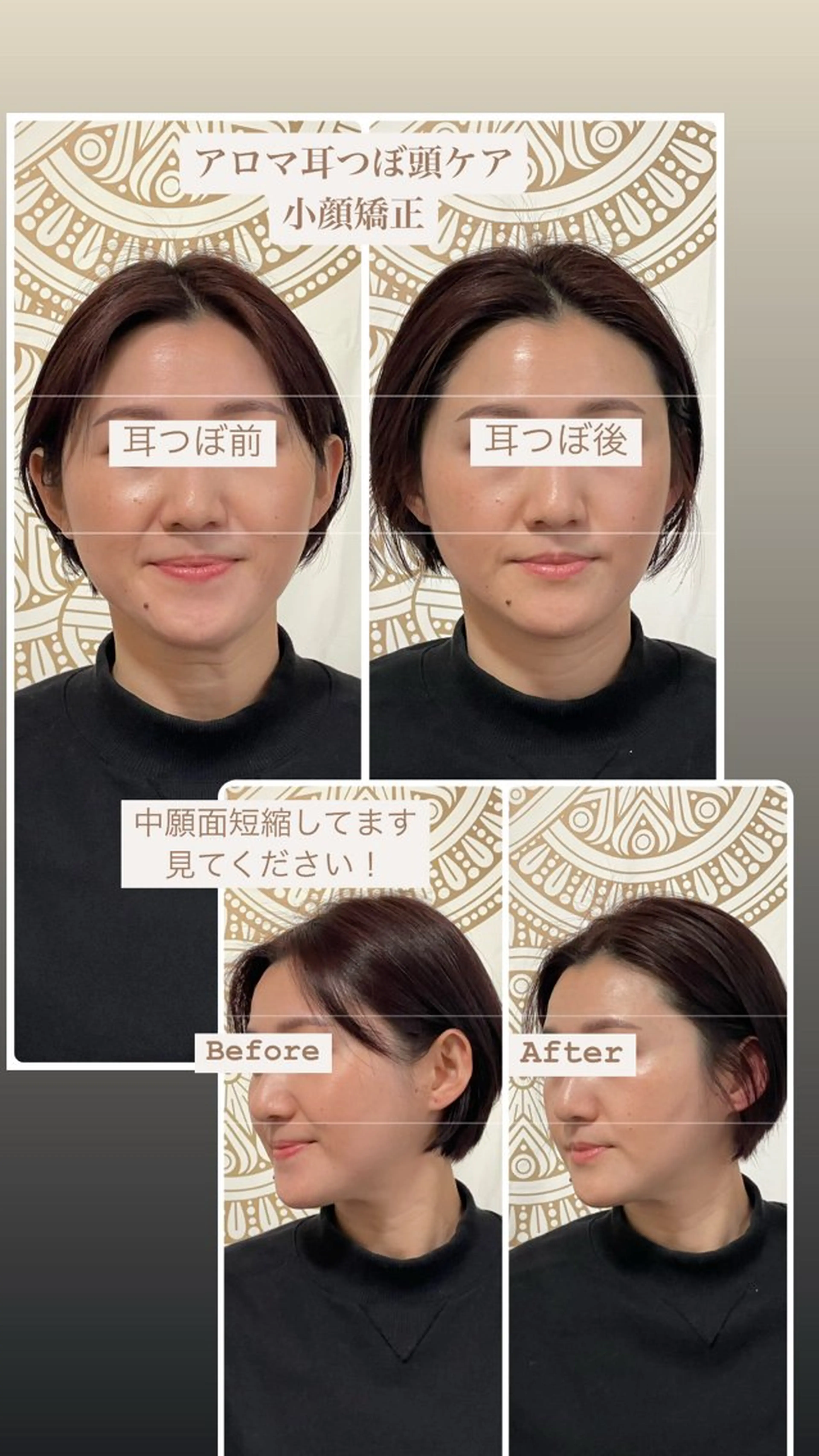 あだち整体エステ 首肩背中のゆるめぐのエステ・リラクイメージ