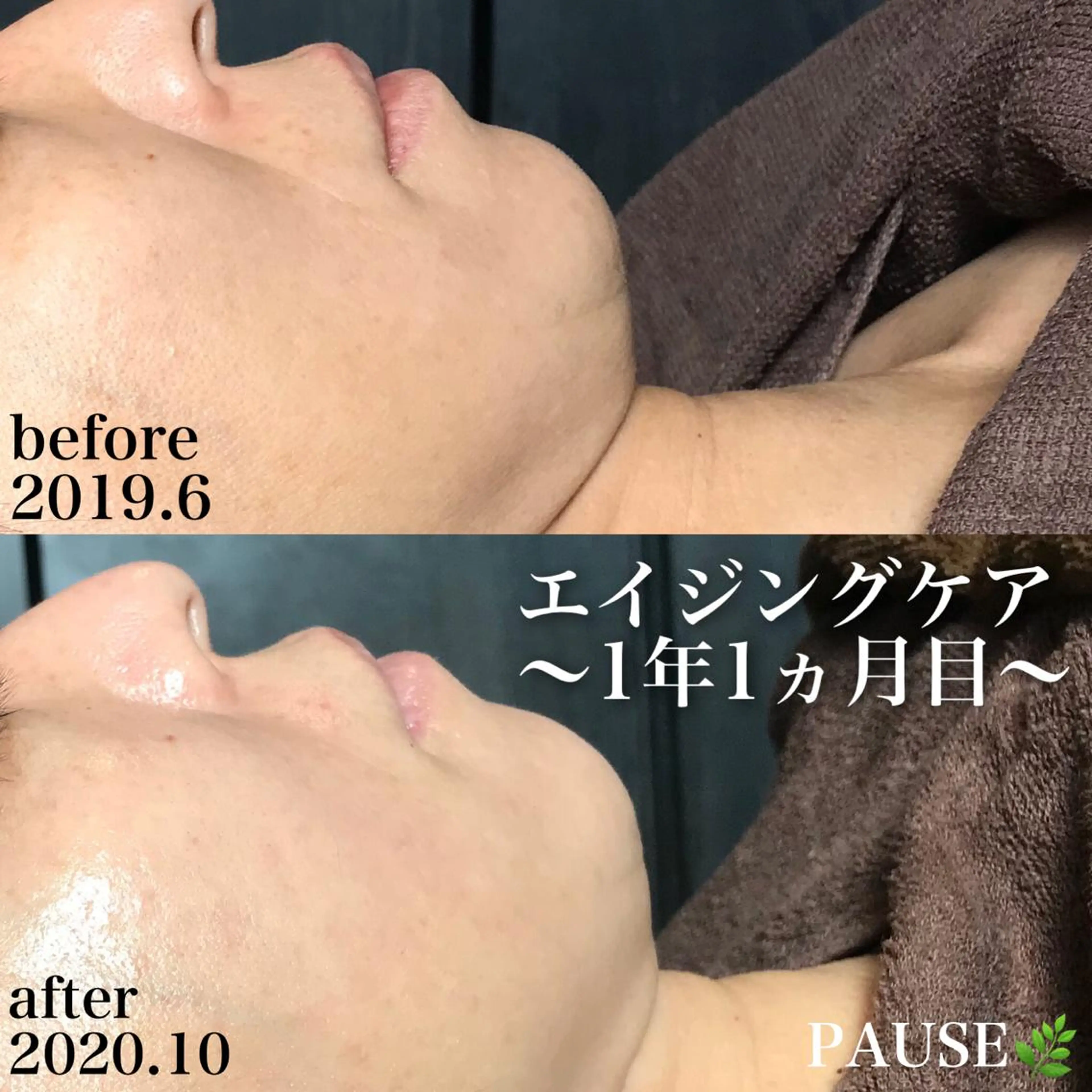 エステ 浜野 恵美のエステ・リラクイメージ