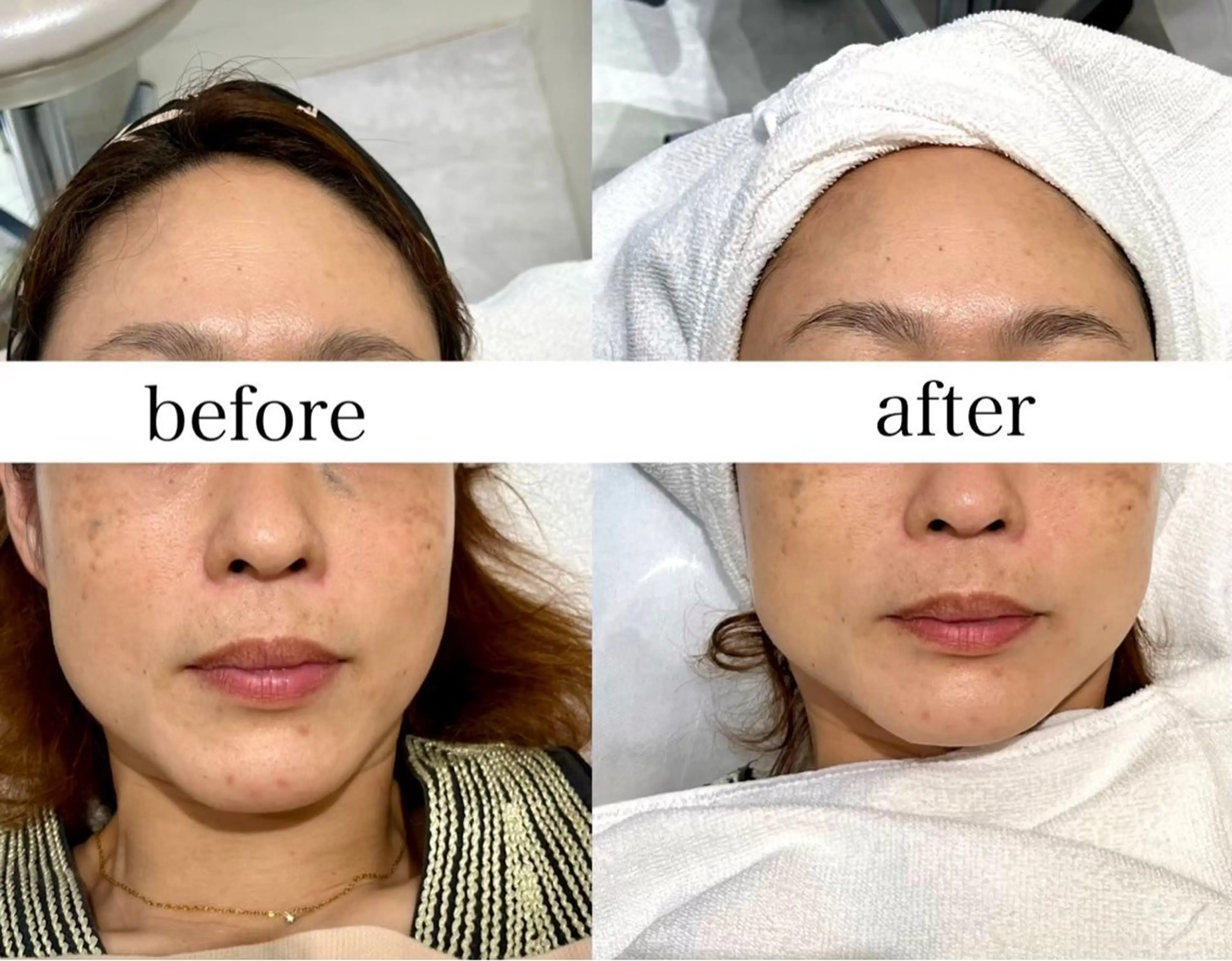 エステ FOXYLASH inoueのエステ・リラクイメージ