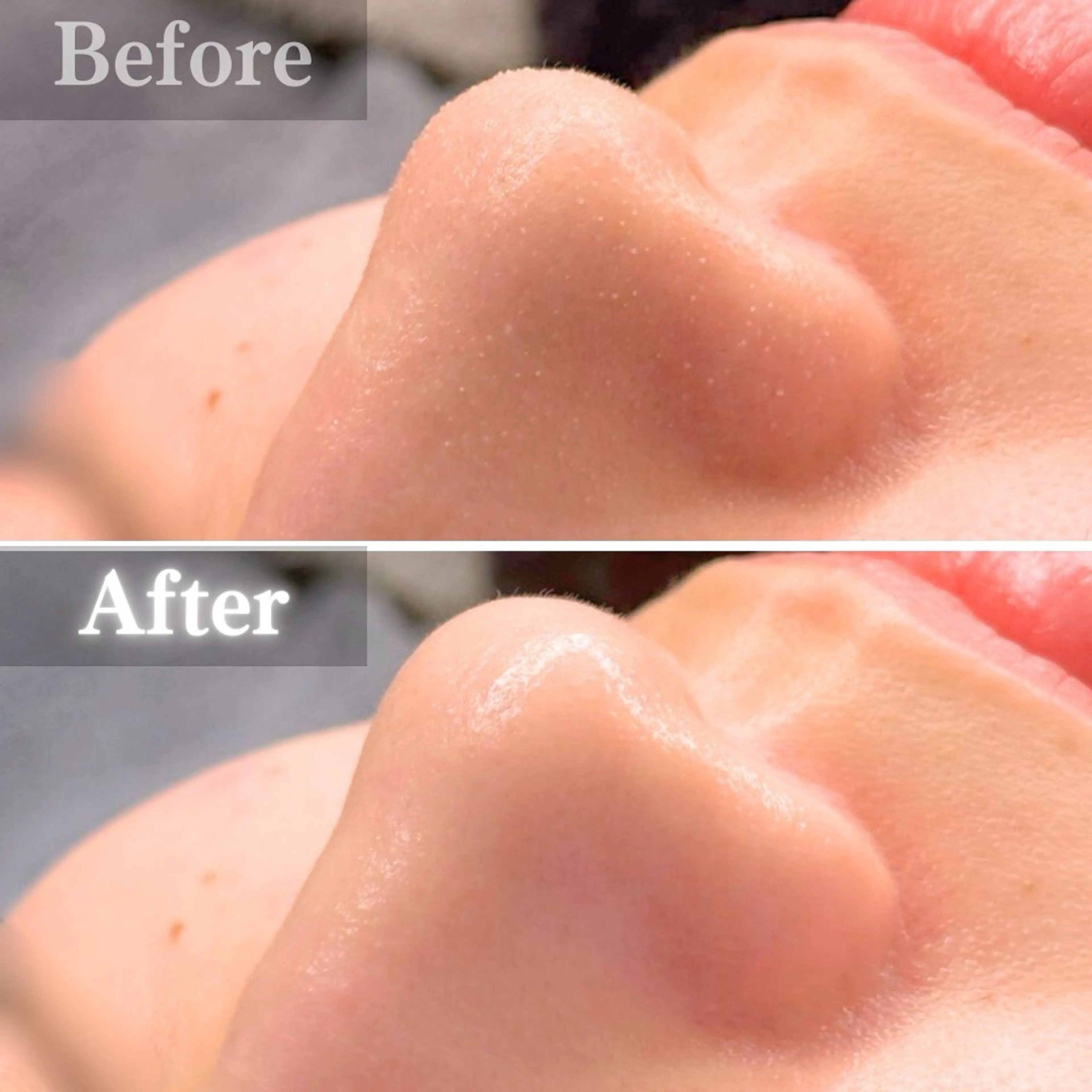 毛穴洗浄特化🫧 オオツカのエステ・リラクイメージ