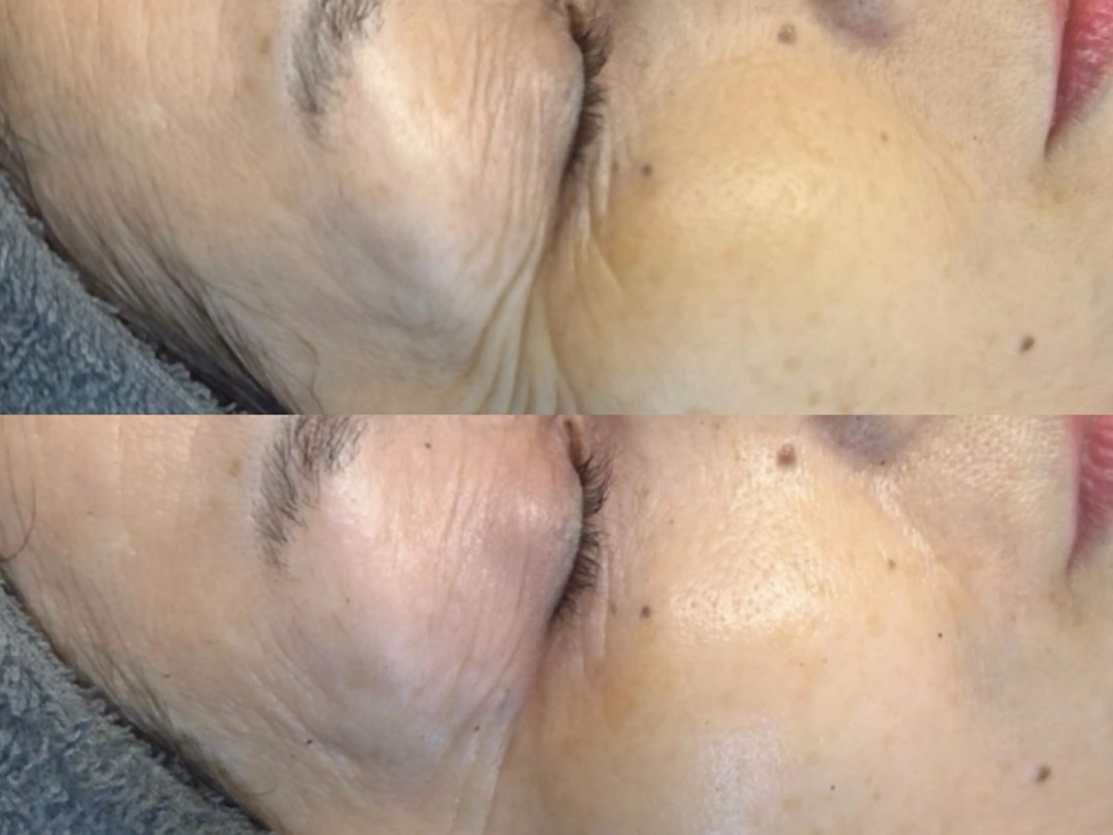 【シワ・たるみ・くすみ特化メニュー】いつまでも若々しい素肌づくり♪の写真