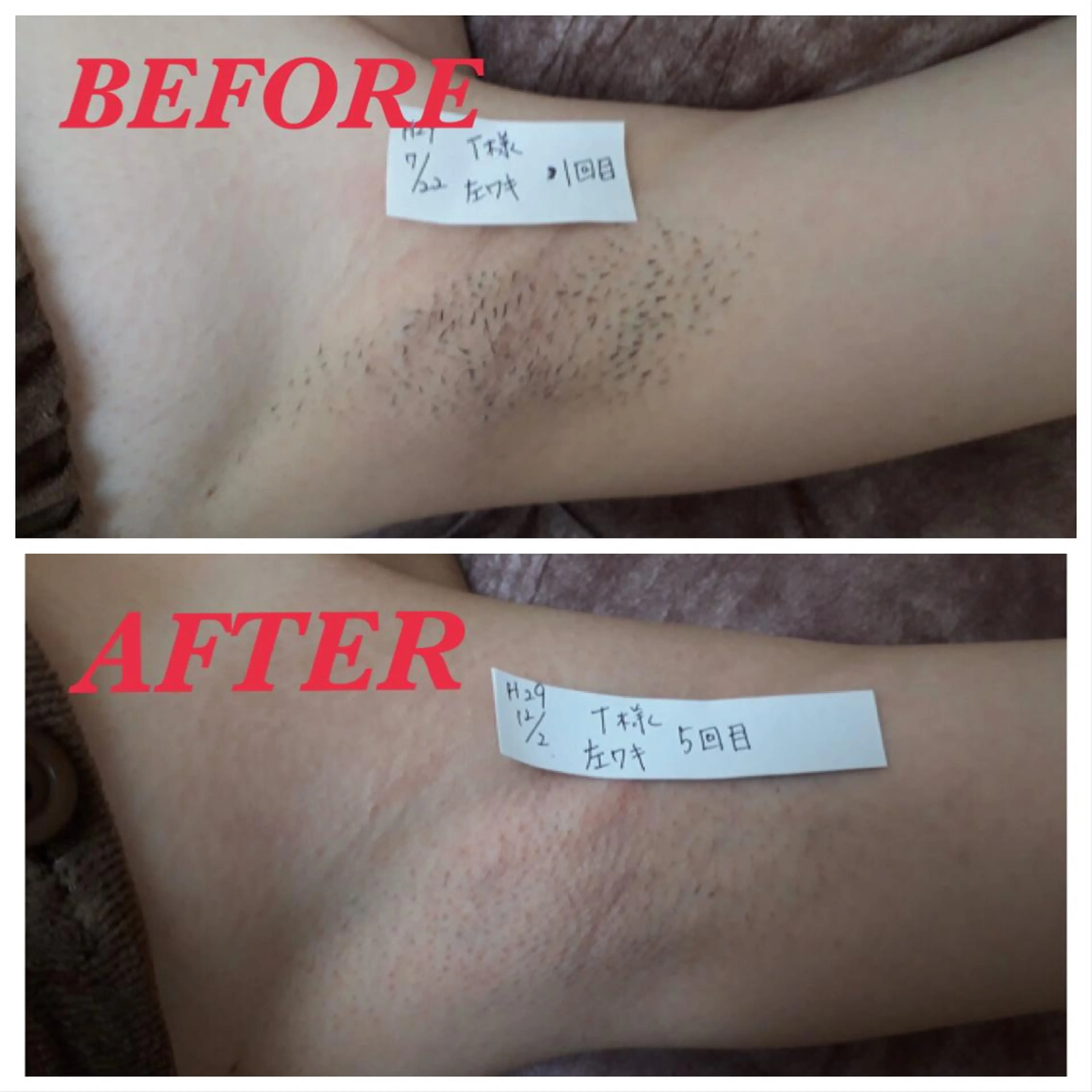 脱毛 Prima〜プリマ〜 名古屋駅店所属・Prima 痩身脱毛 にごうかおりのエステ・リラクイメージ