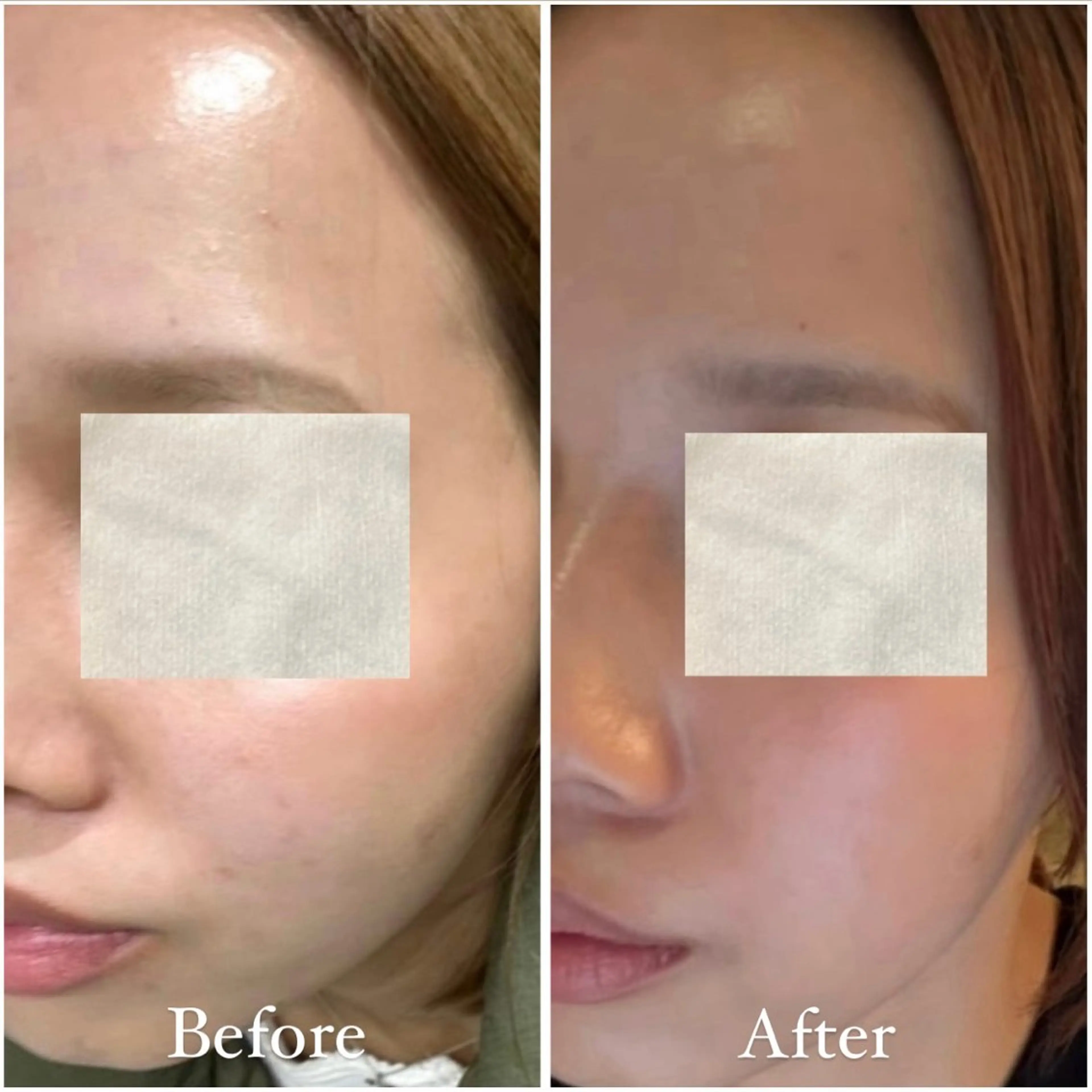 Tulipe Chihoのエステ・リラクイメージ