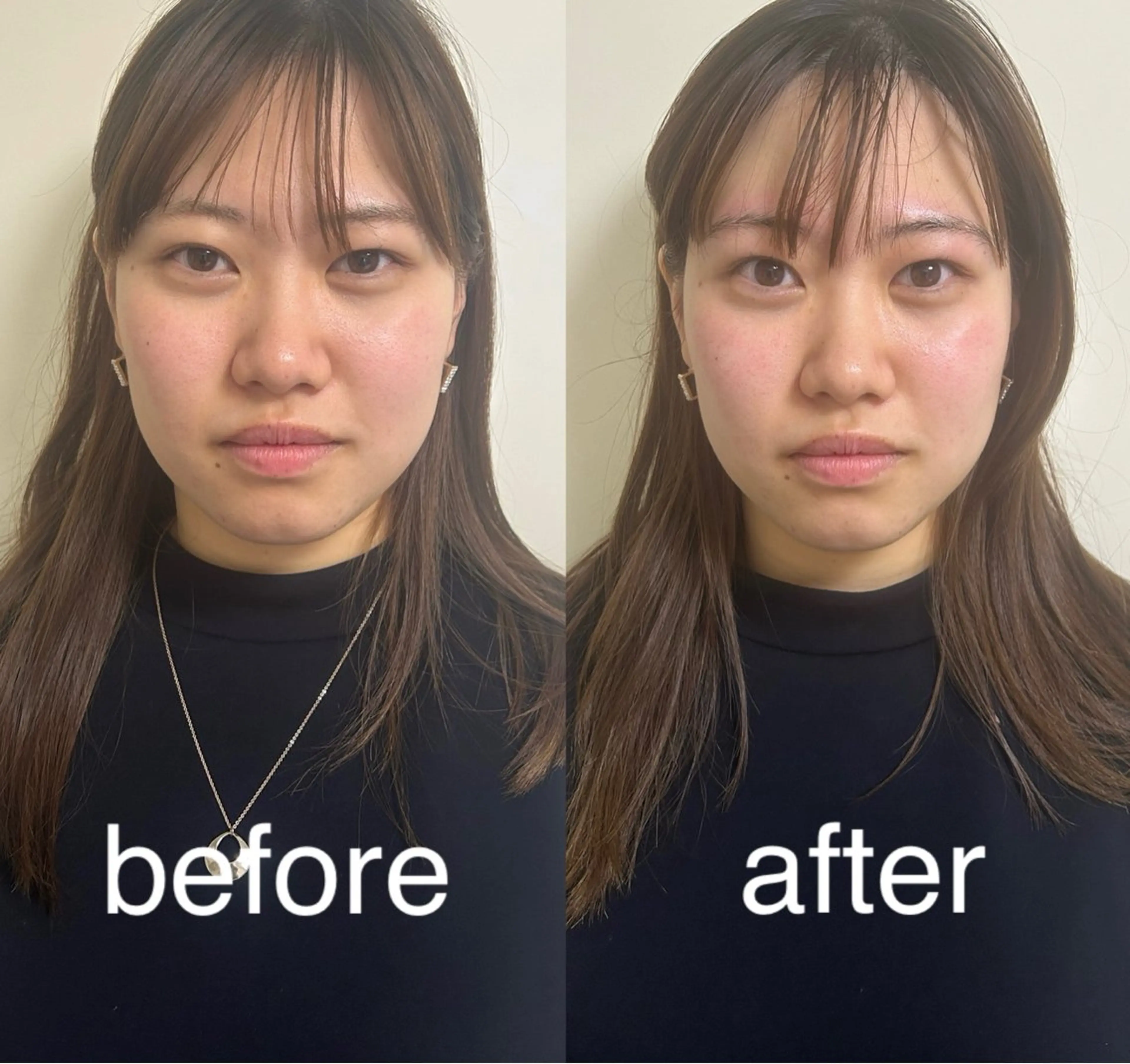 美容鍼灸サロン mahoroba院長のエステ・リラクイメージ