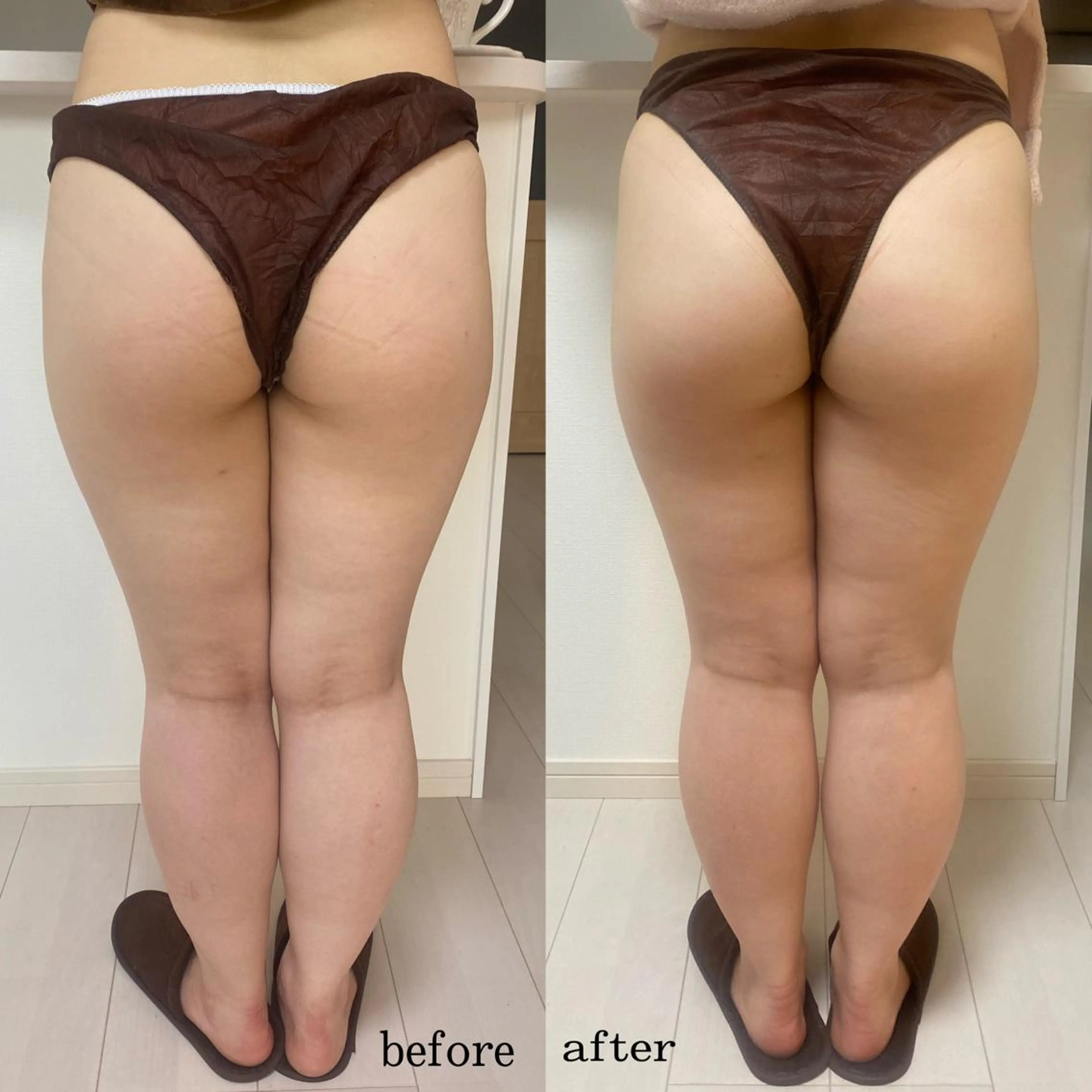 エステ リラク 整♡深層リンパ ronronのその他イメージ