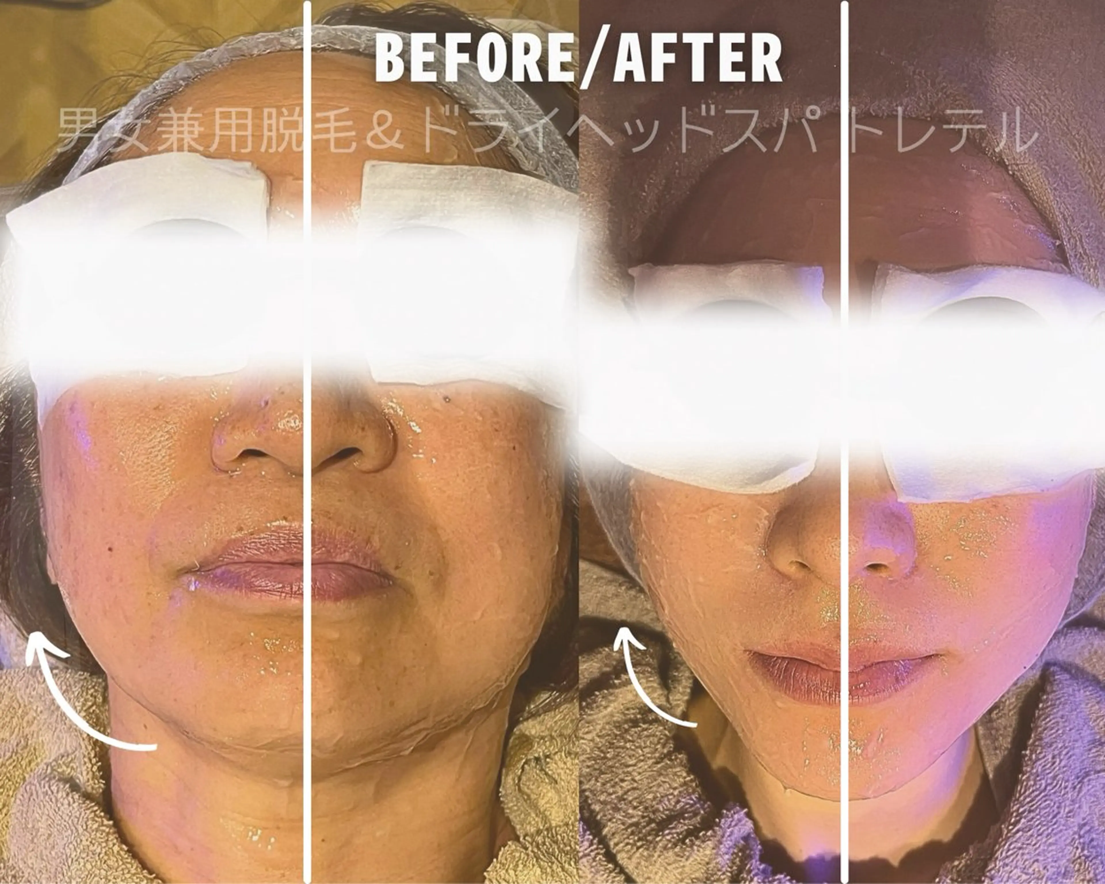 男女兼用脱毛&ドライ ヘッドスパ トレテルのエステ・リラクイメージ