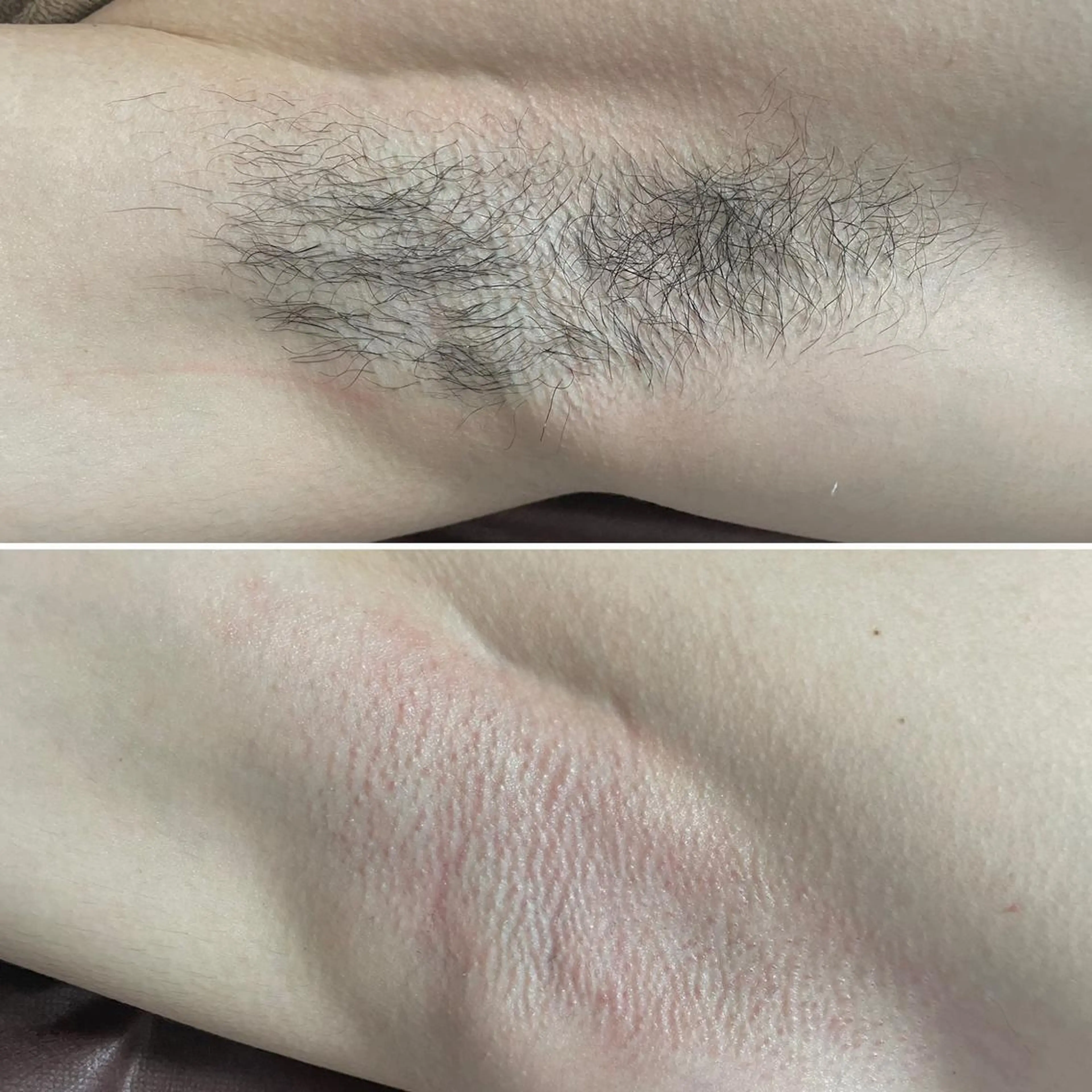 アイブロウ メンズ キッズ 脱毛 Epina 千葉店 【エピナ】のエステ・リラクイメージ