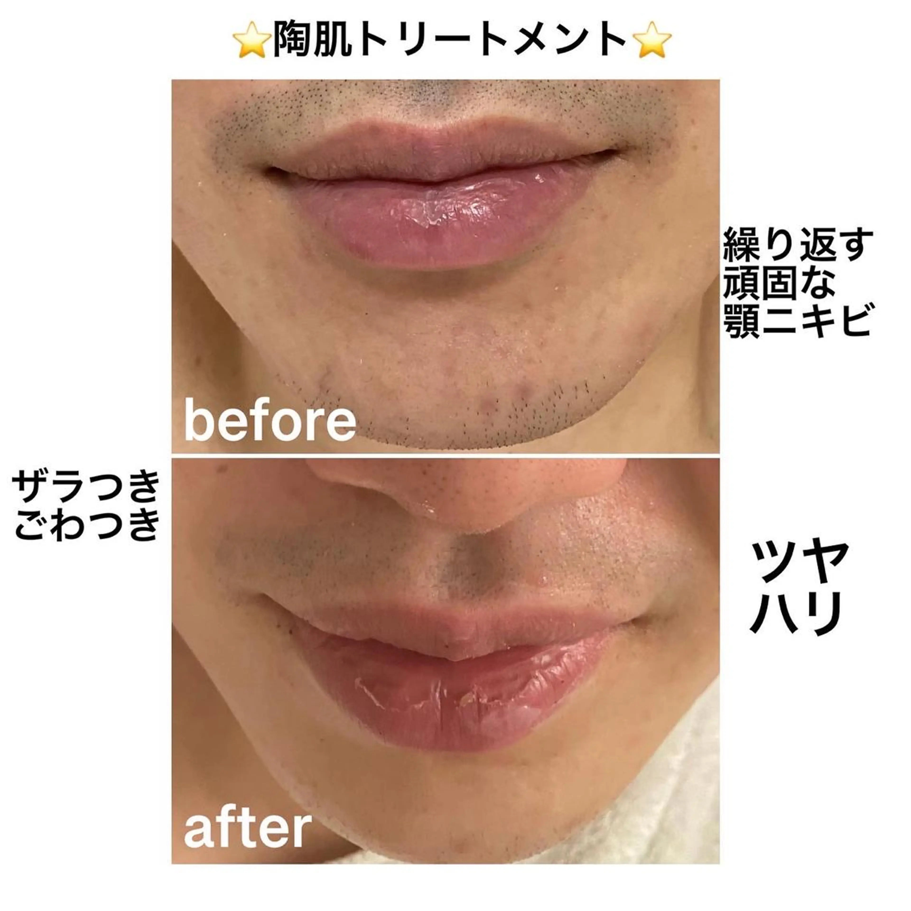 その他 アロマ•ピーリング SalonYokoのその他イメージ