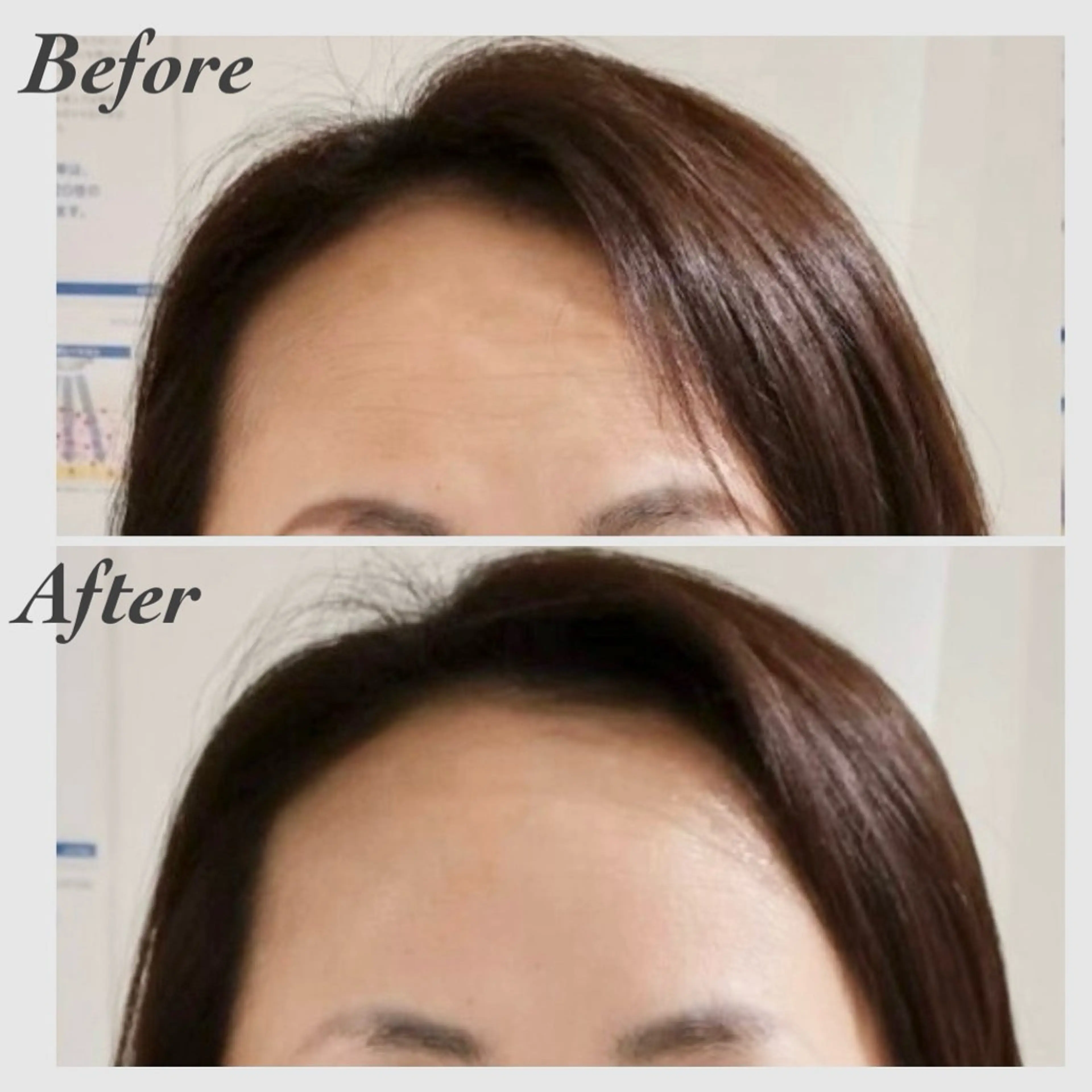 小顔・ツルツル素肌 ハリステリアのエステ・リラクイメージ