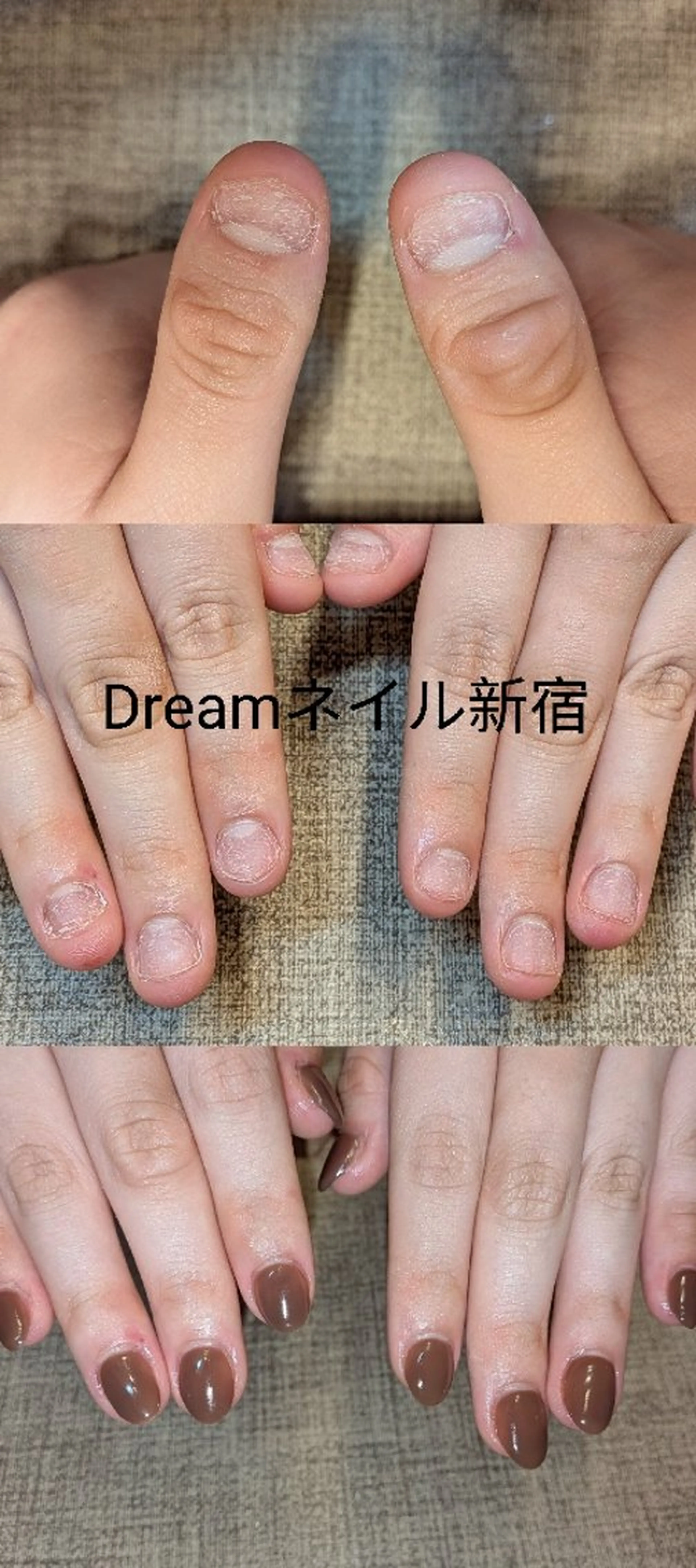 ネイル ブラウン ハンドネイル ハンドケア フィルイン・深爪矯正 長さ出し🎀のネイルデザイン