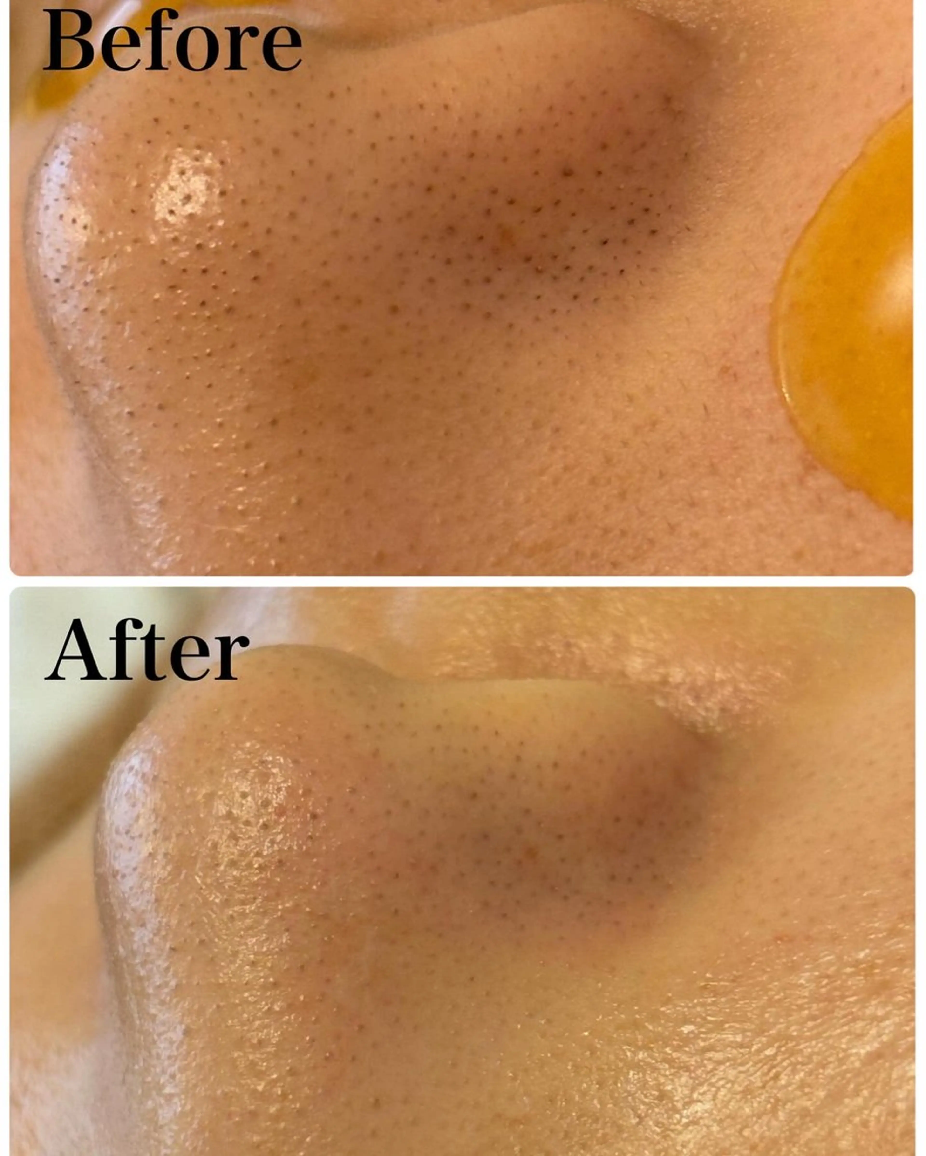 韓国肌管理 【毛穴専科】のエステ・リラクイメージ