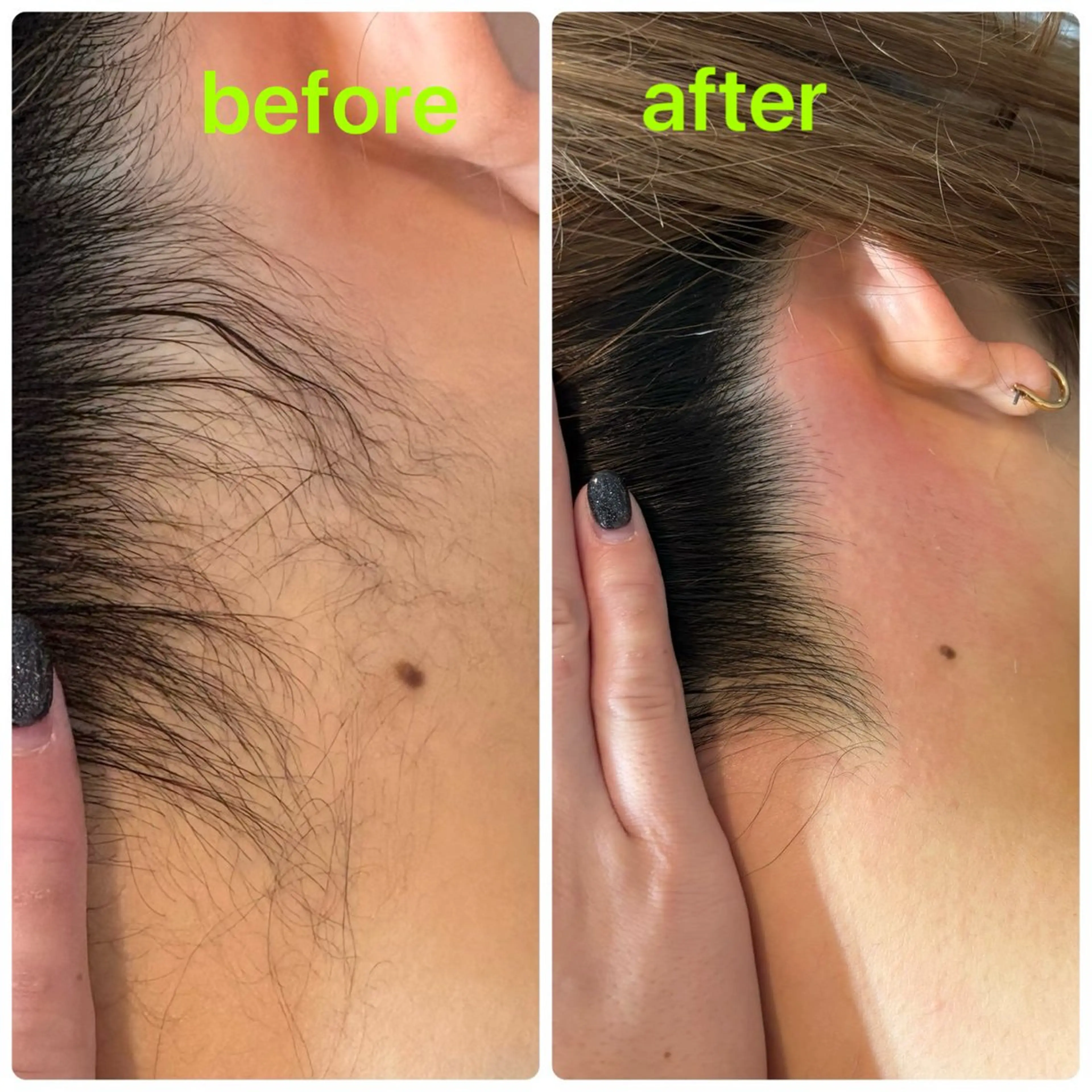 うなじWAXの写真