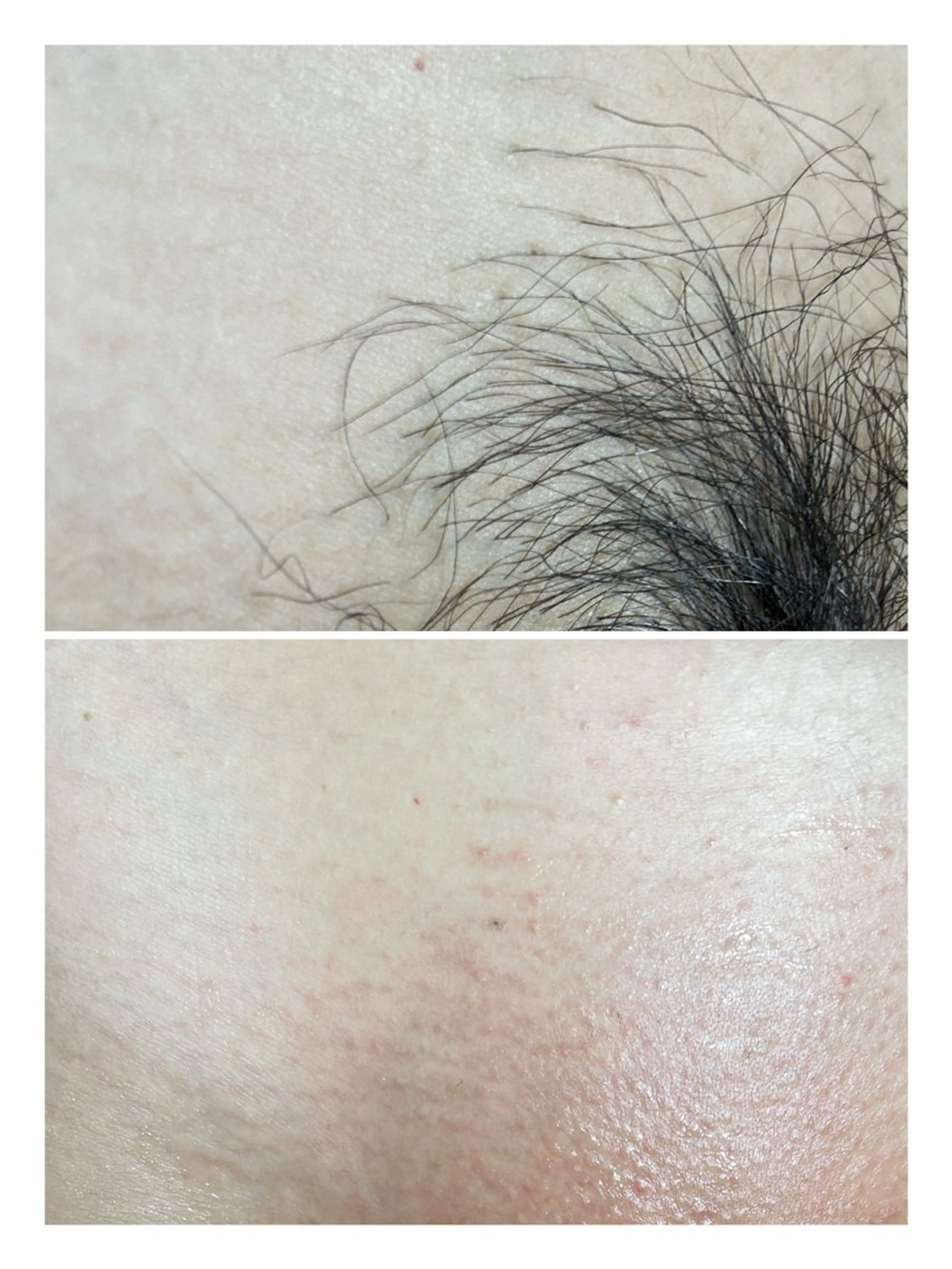 脱毛 STELLAR. 谷岡恵里香のエステ・リラクイメージ