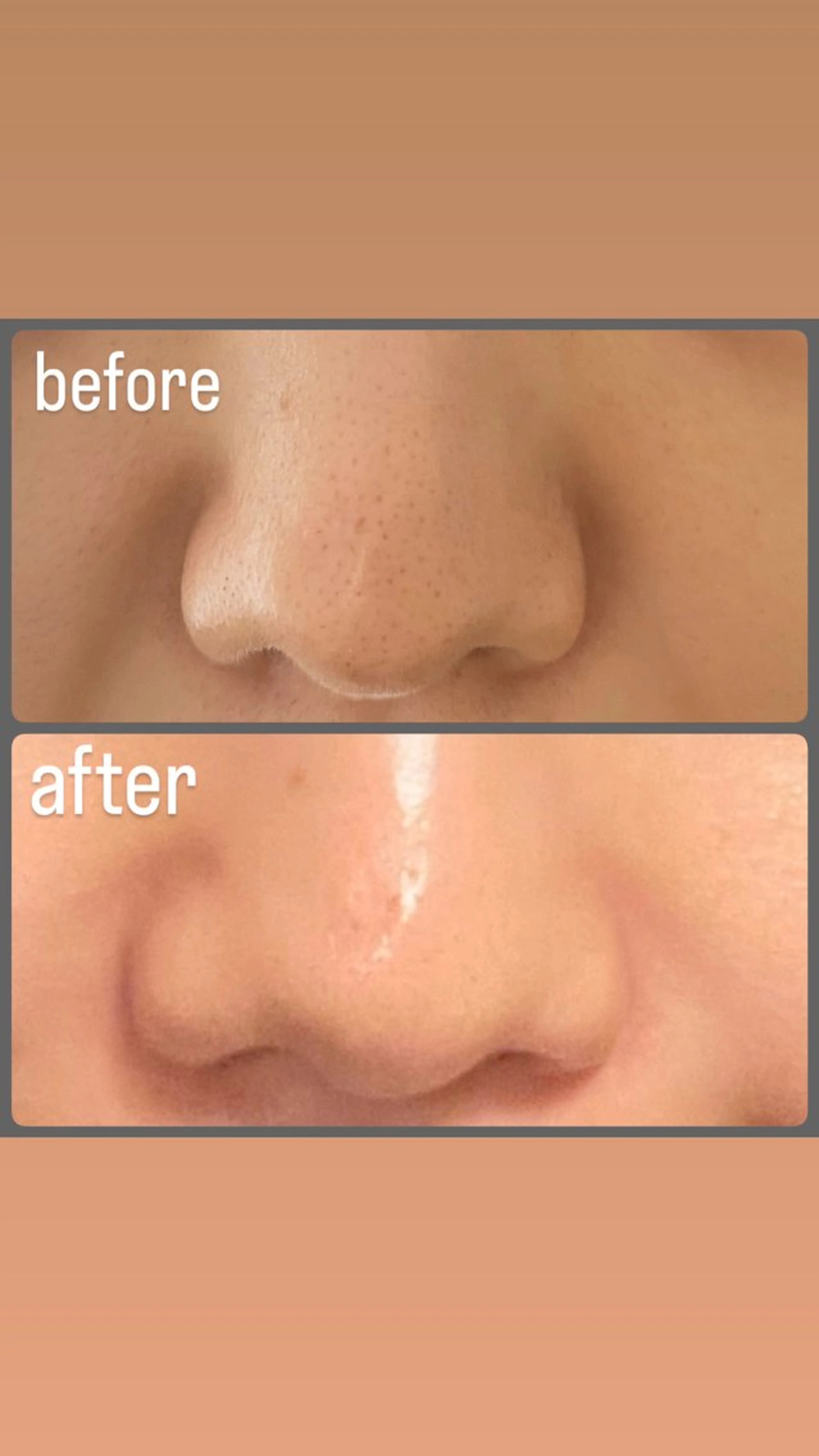 エステ 長谷川 由梨奈のエステ・リラクイメージ