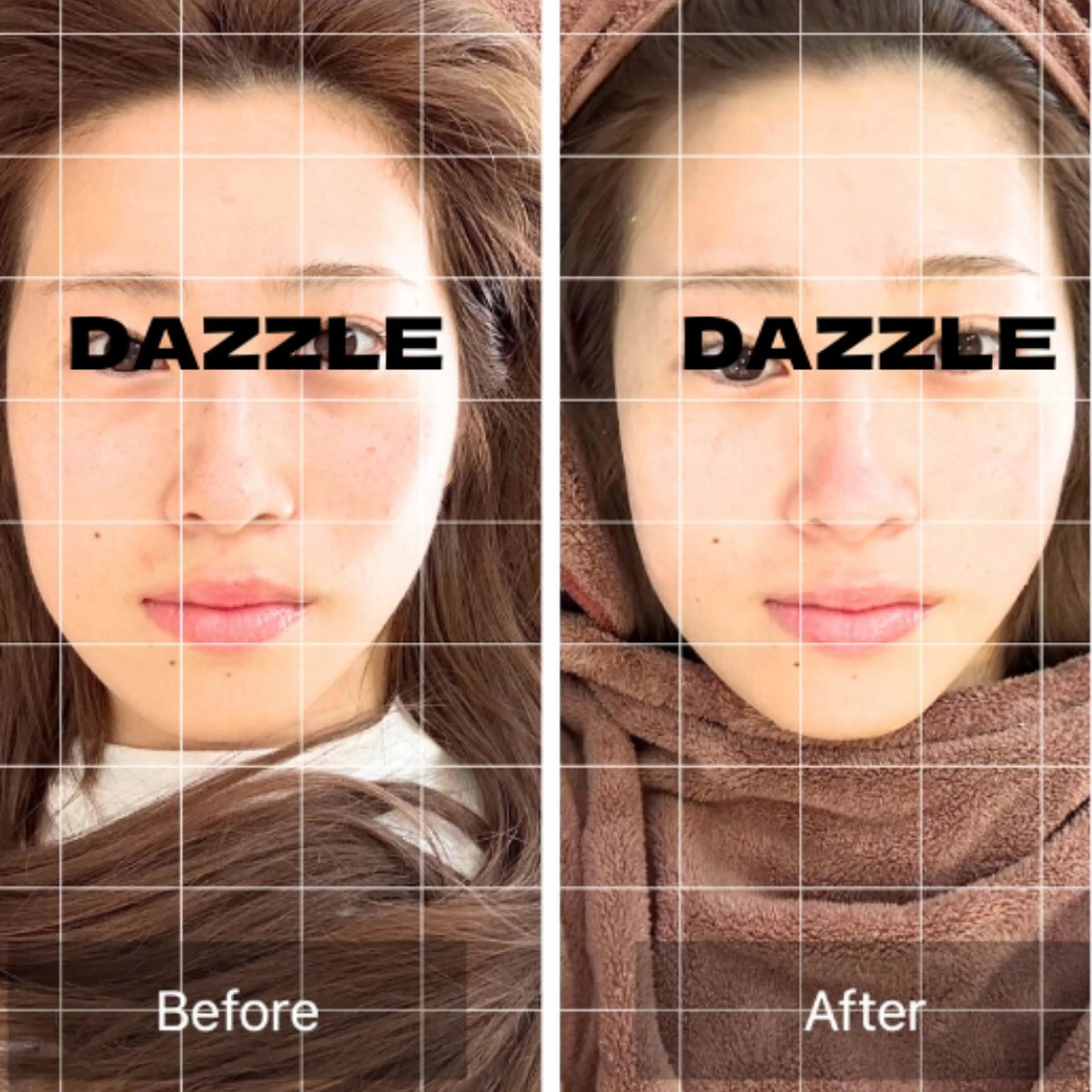 小顔・たるみ専門 DAZZLEのエステ・リラクイメージ