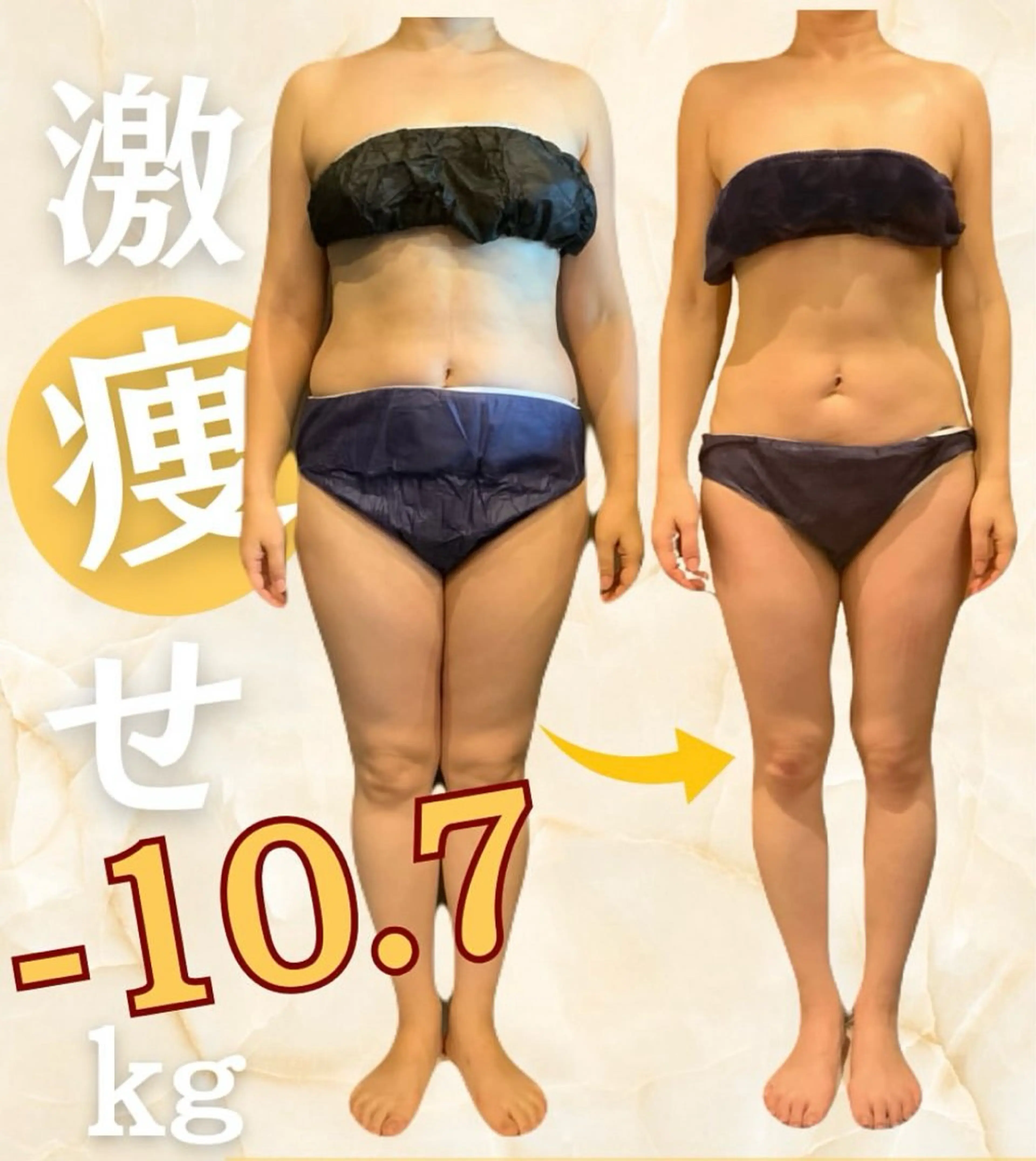 ハイパーナイフ/痩身 🌸CHARME原井のエステ・リラクイメージ