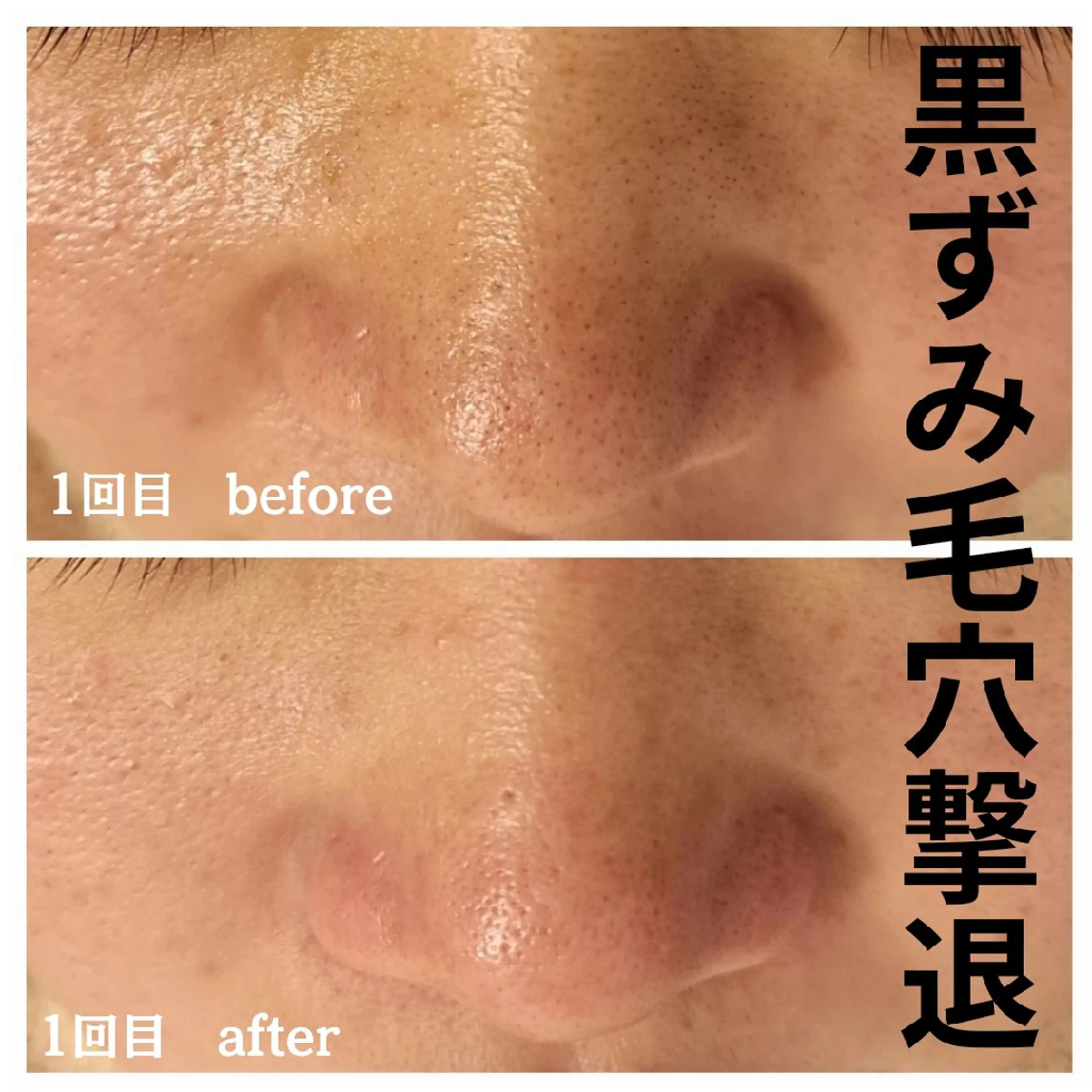 フェイシャル専門サロ ン　ERINのエステ・リラクイメージ