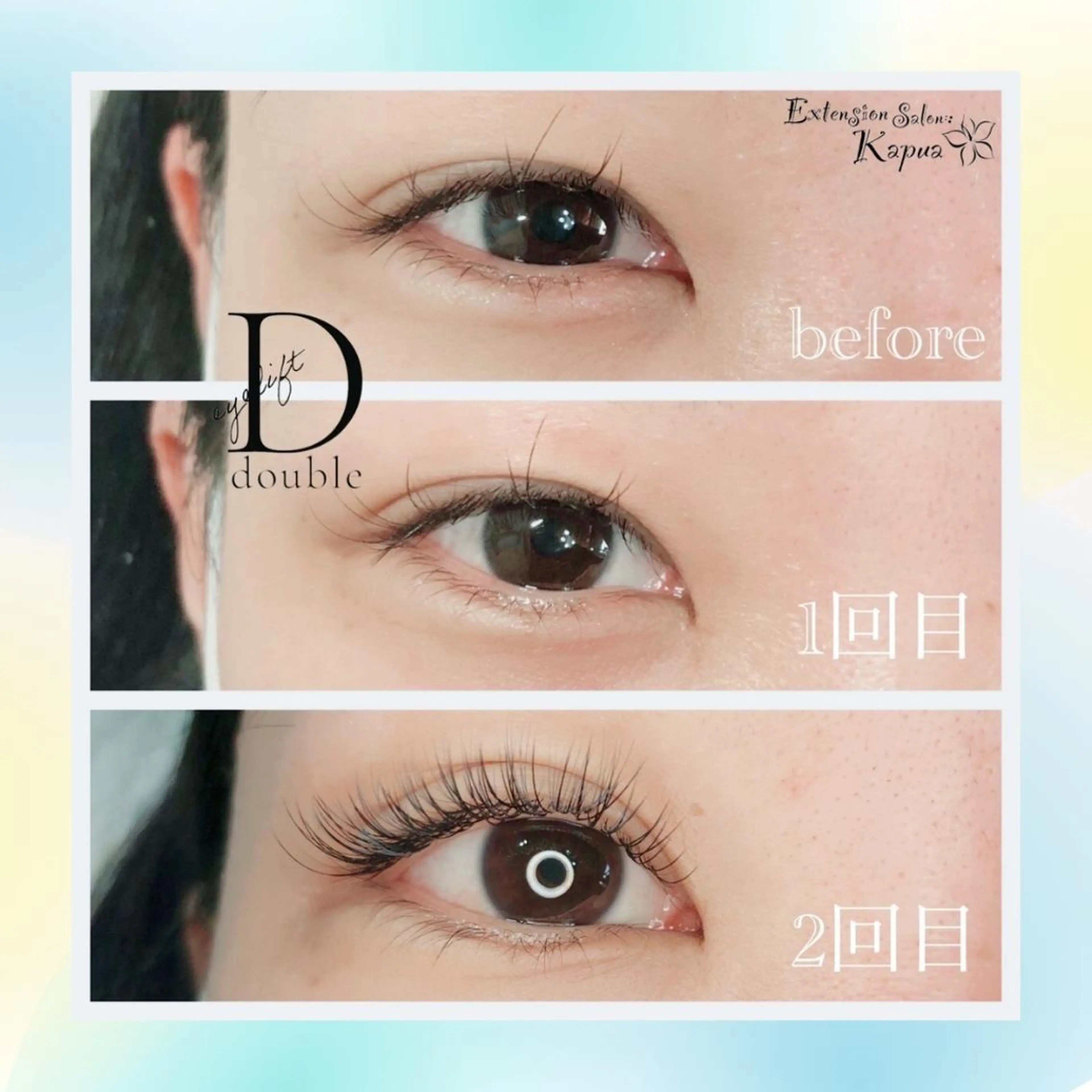 アイストレッチ(単品)の写真