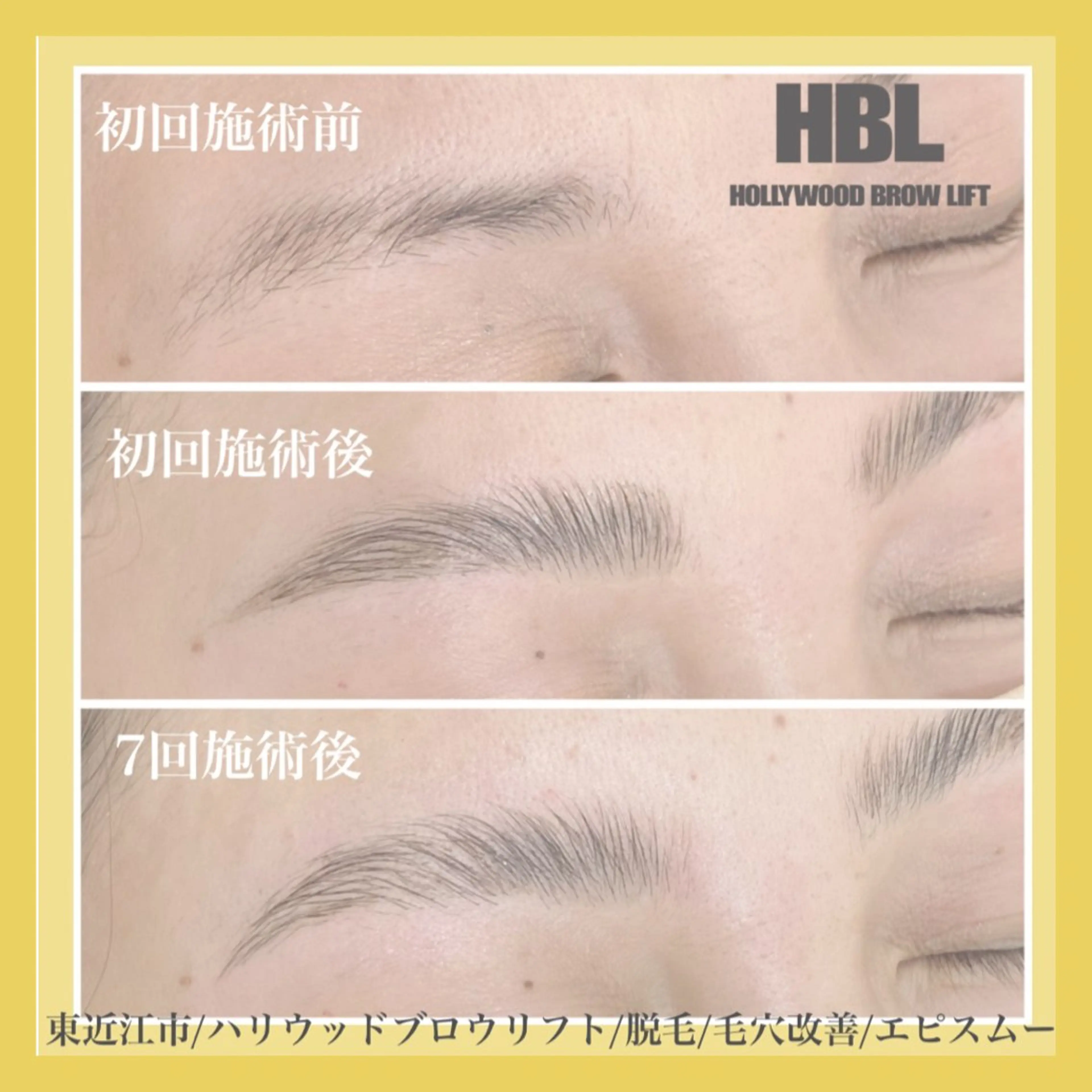 メンズ アイブロウ その他(アイブロウ) epismoo 脱毛/HBL/毛穴の眉毛・アイブロウイメージ