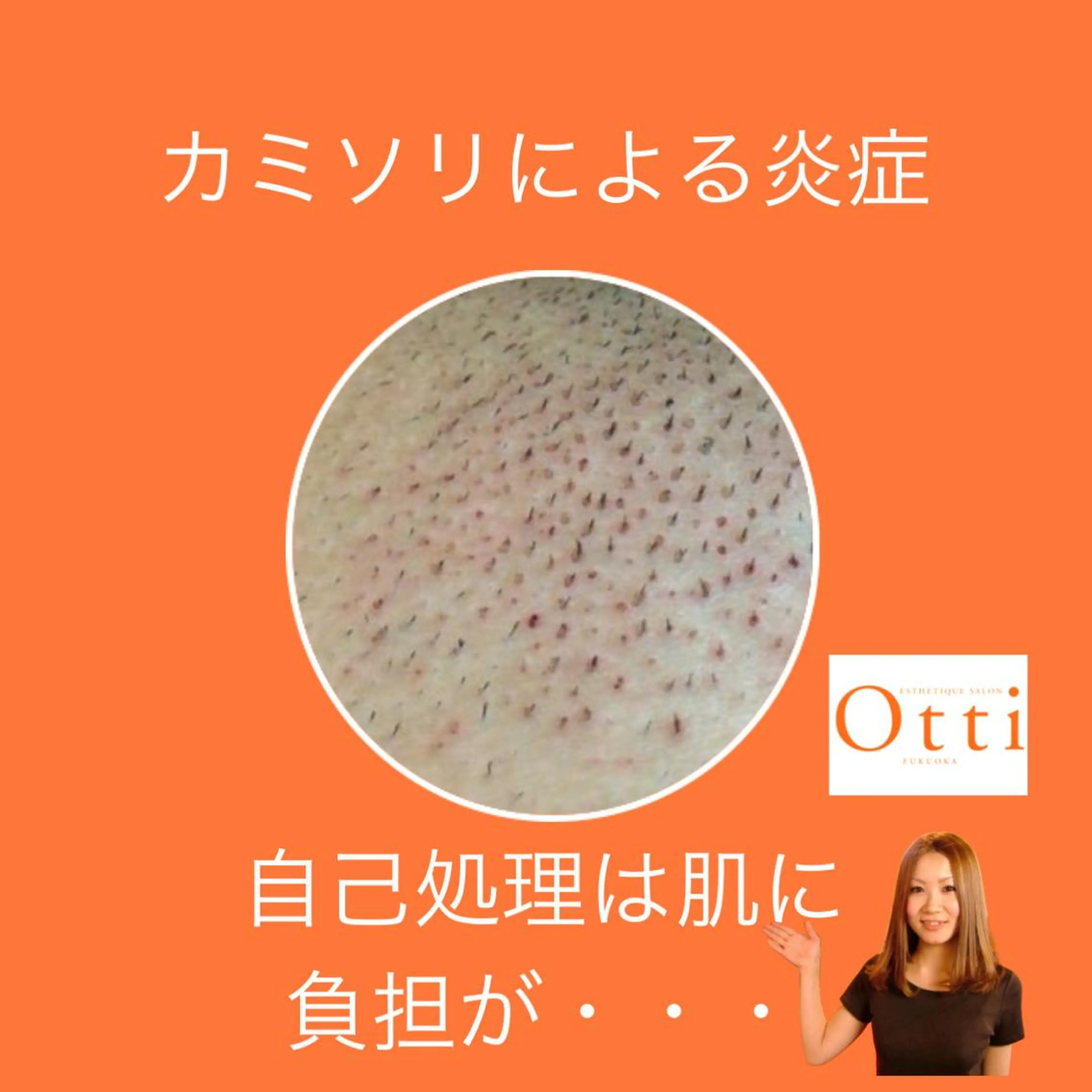 脱毛 エステ脱毛サロン Otti  オッティのエステ・リラクイメージ