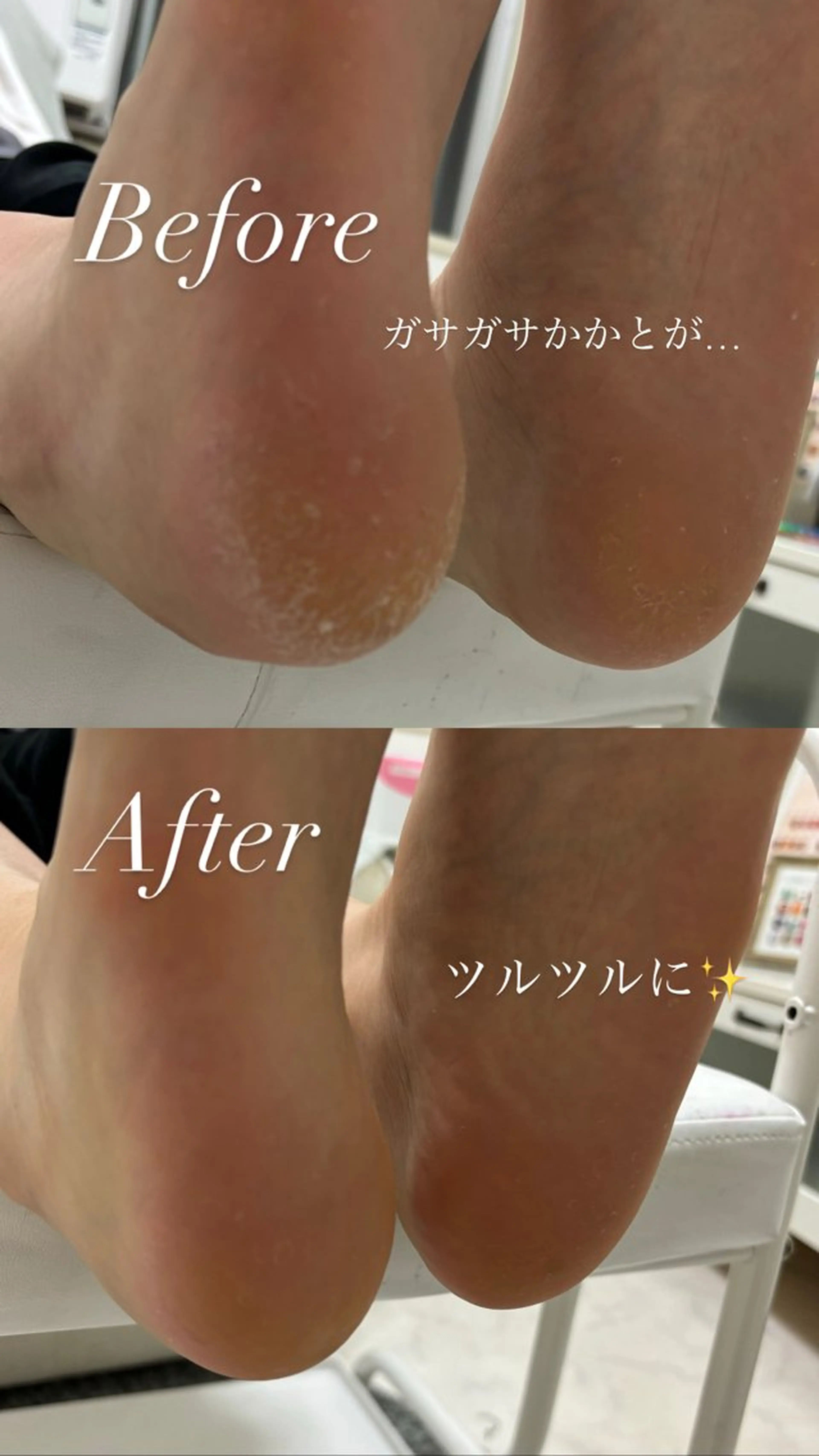 《平日限定特別価格✨》フットネイルケア×足裏角質ケア👣¥6000-の写真