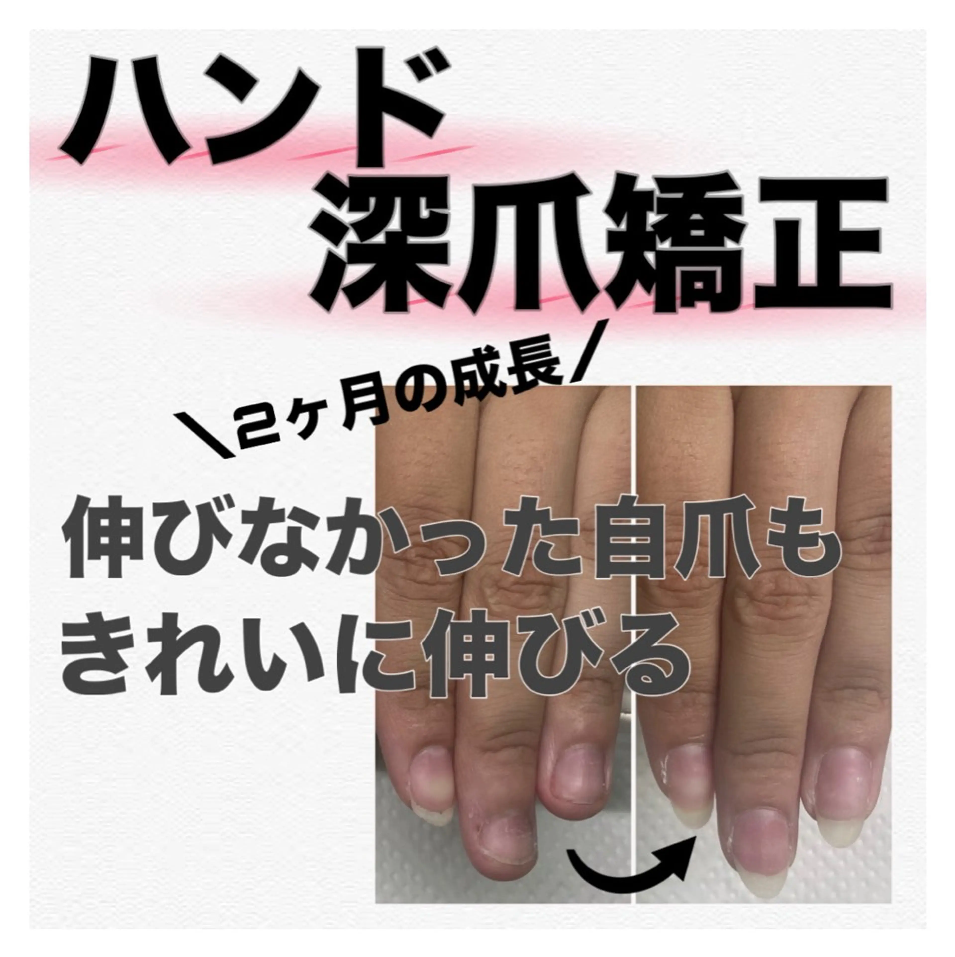 ネイル ジェルネイル ラメ(グリッター) ピンク ハンドネイル ハンドケア nail salon petillantのネイルデザイン