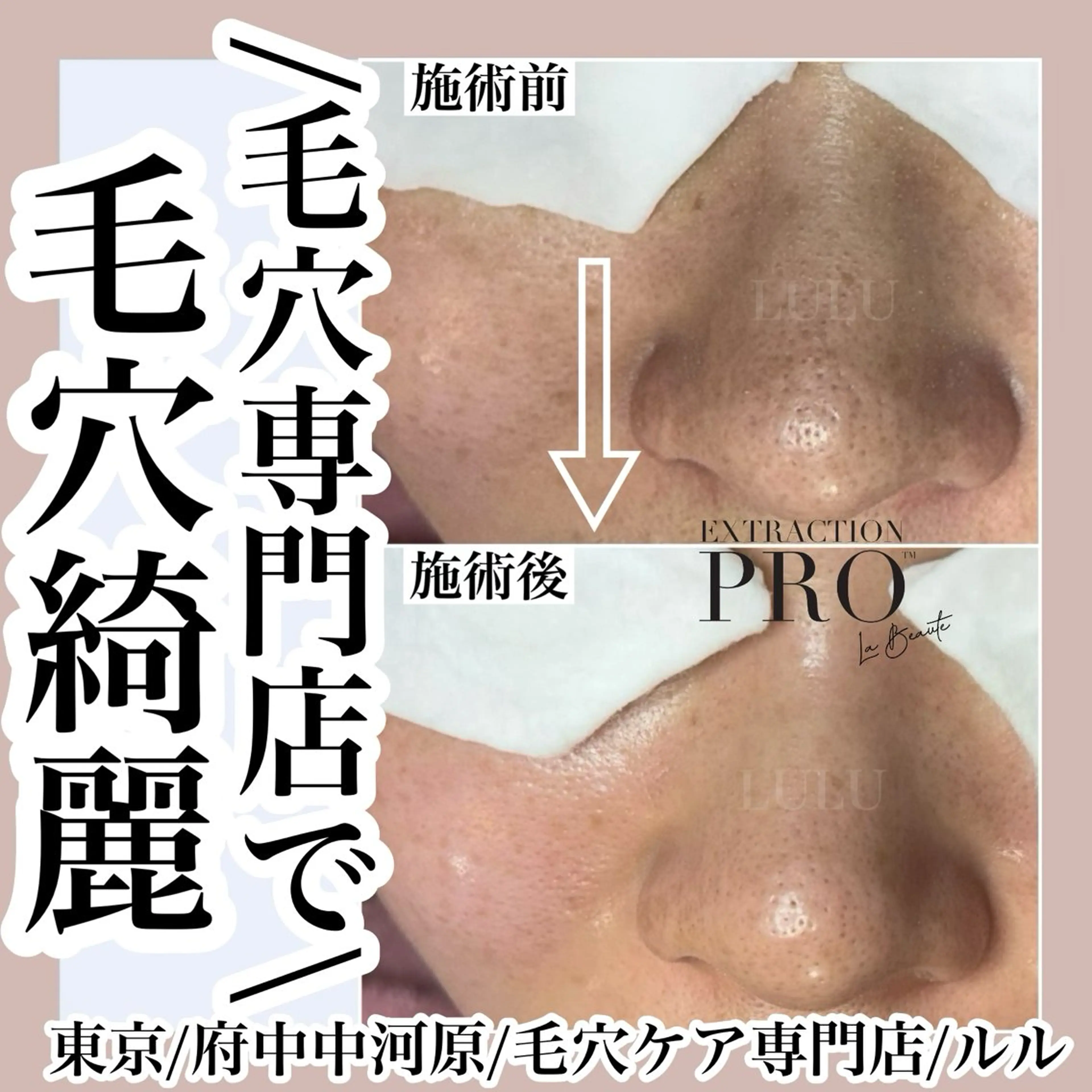 エステ LULU ルルのエステ・リラクイメージ