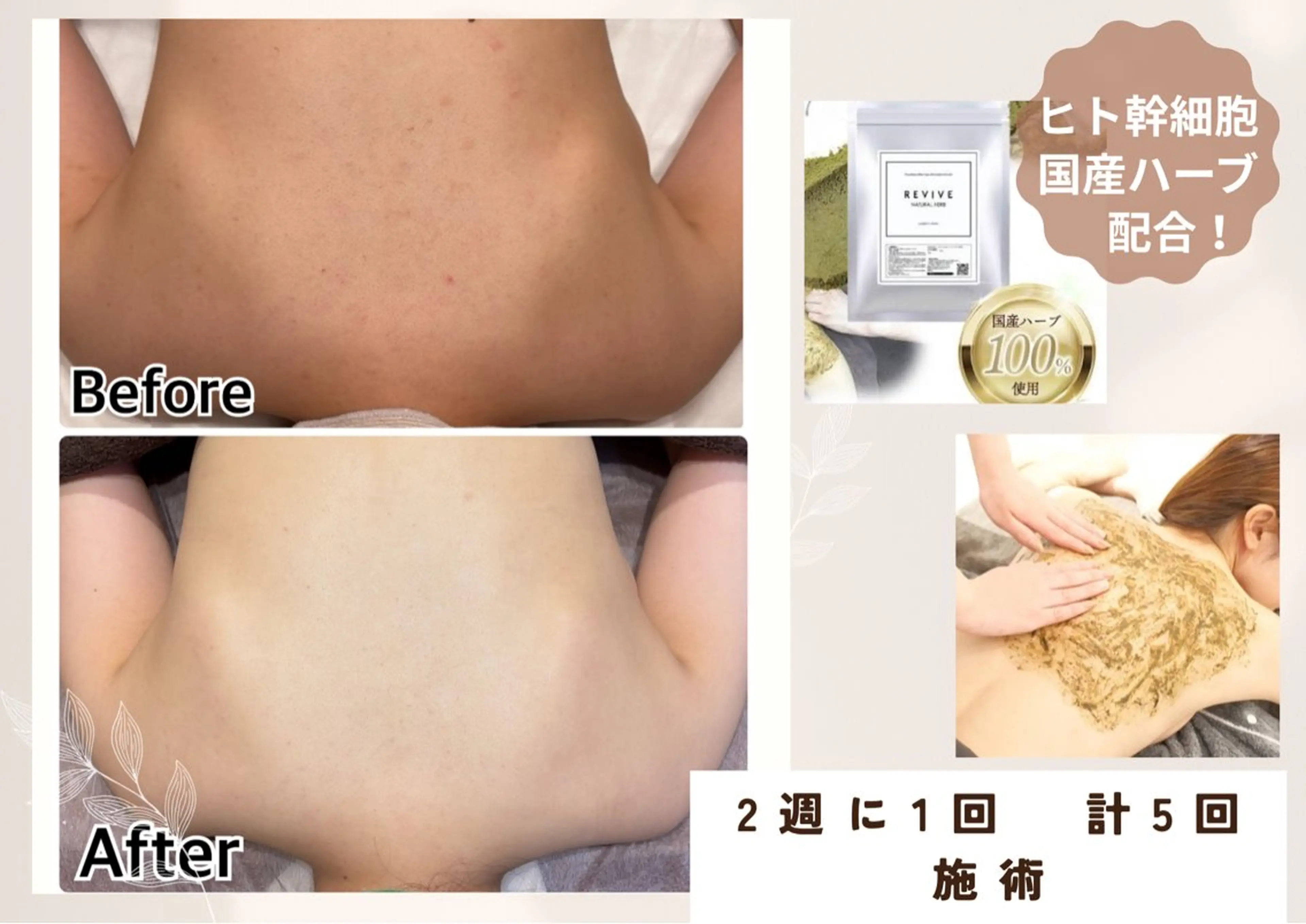 美肌脱毛サロン muroのエステ・リラクイメージ
